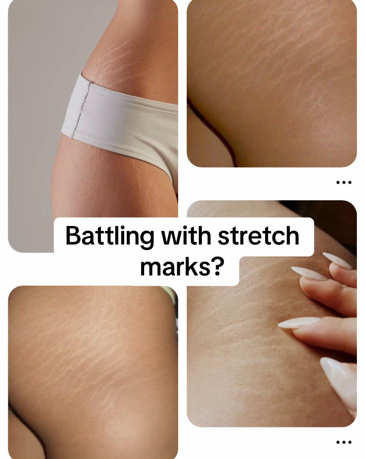 @🧴Marvell Skincare Benin city