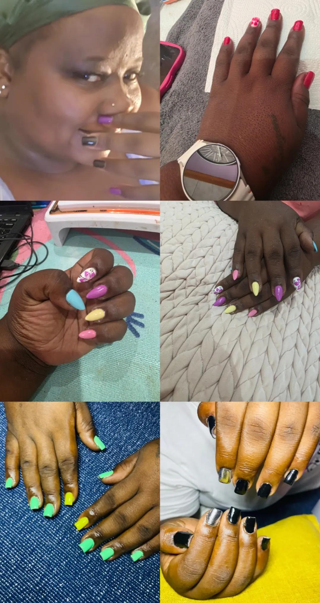 @Tshifhiwa Amputee 🦿