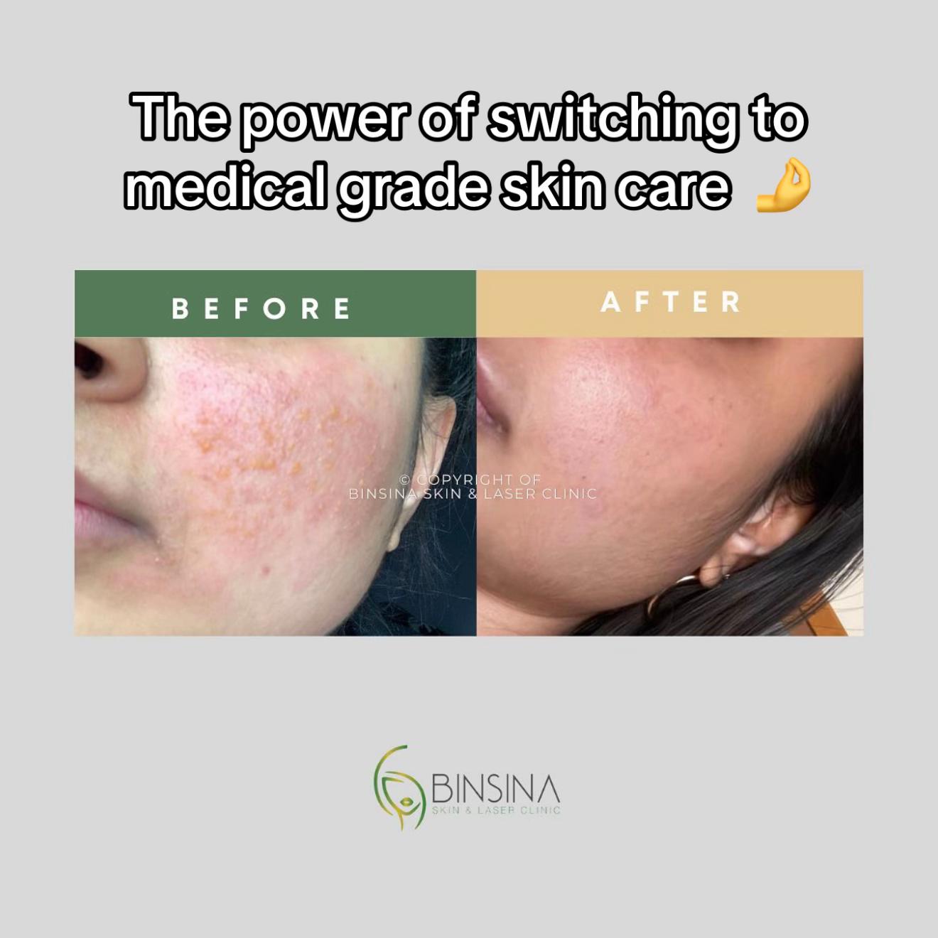 @Binsina Laser & Skin Clinic