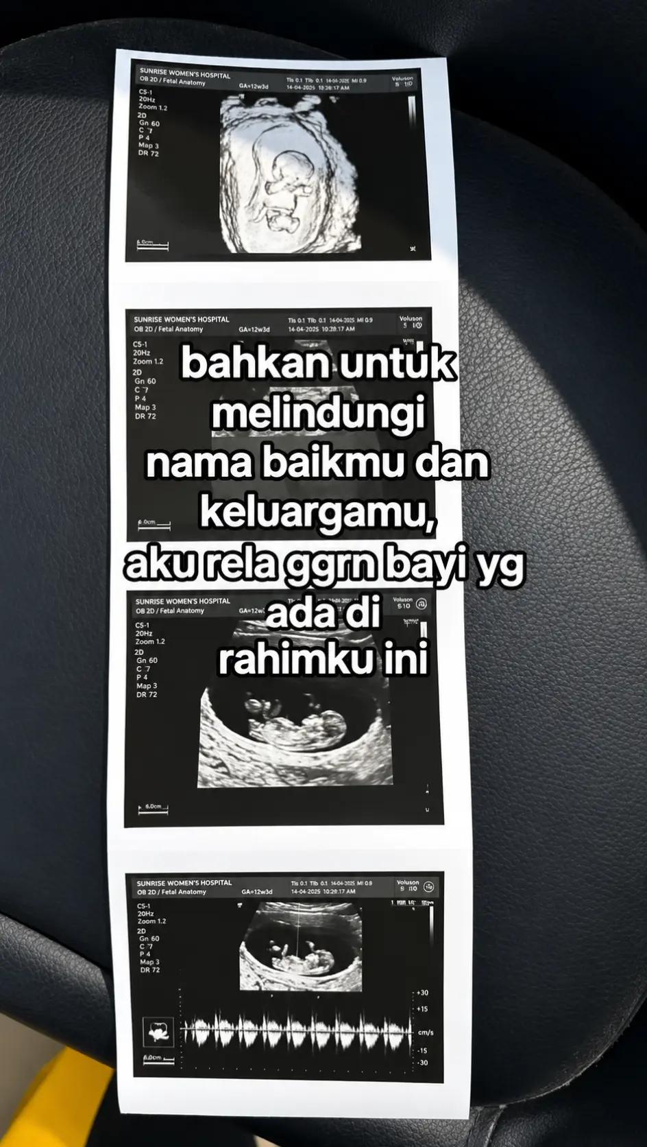 @ARISKA PUTRI