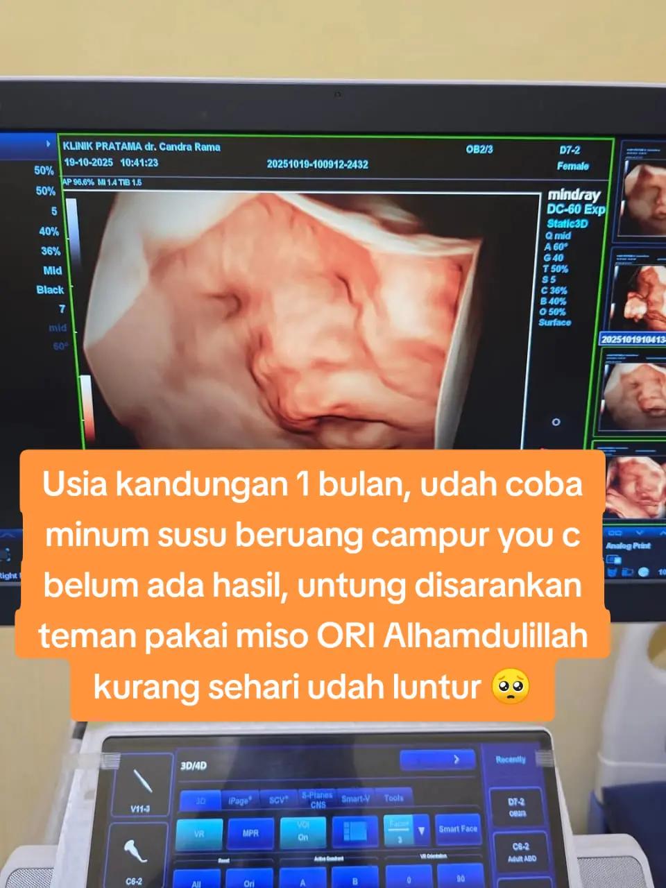 @APOTEK_MISO_2026_🔚