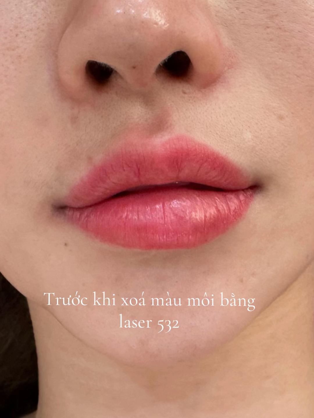 @Jang
