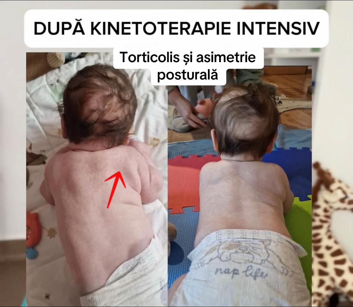 @Antonia | KinetoPediatrie