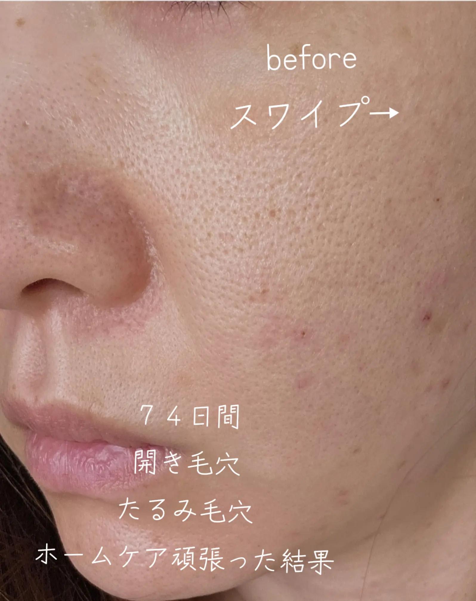 @リアル毛穴改善記録