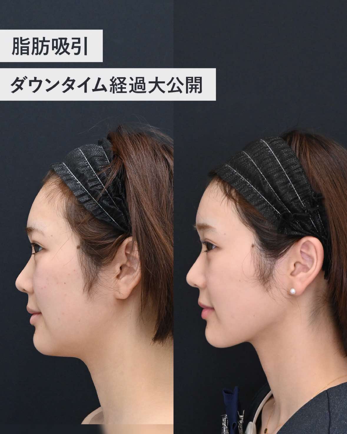 @名倉俊輔 輪郭.若返りの美容外科