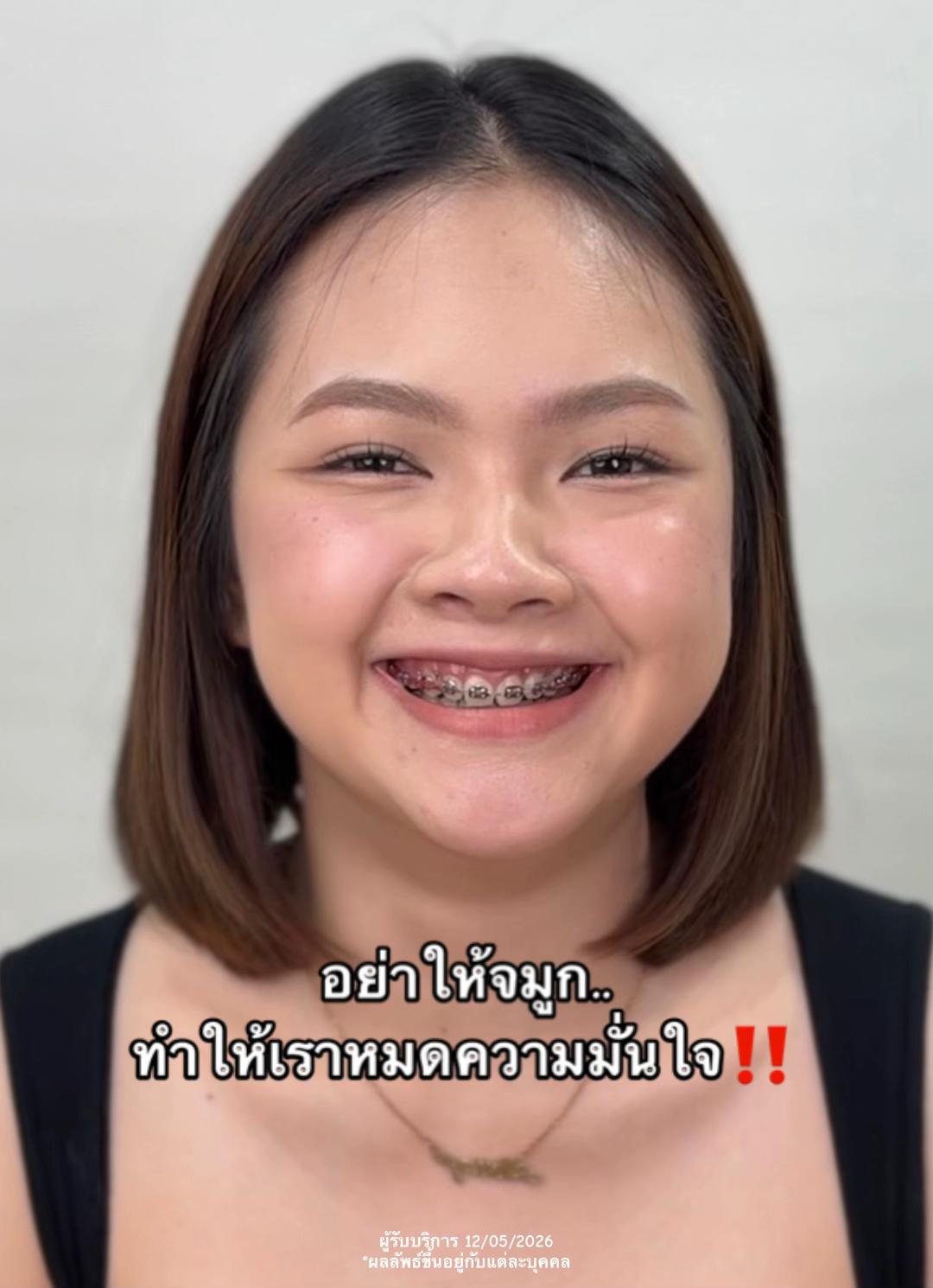 @หมอธัญ LENISTA