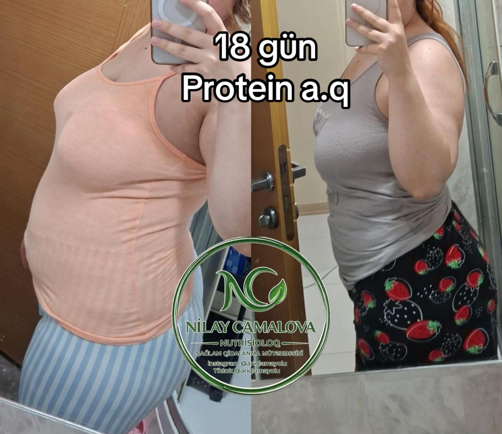@Nutrisioloq Nilay Camalova 🥑