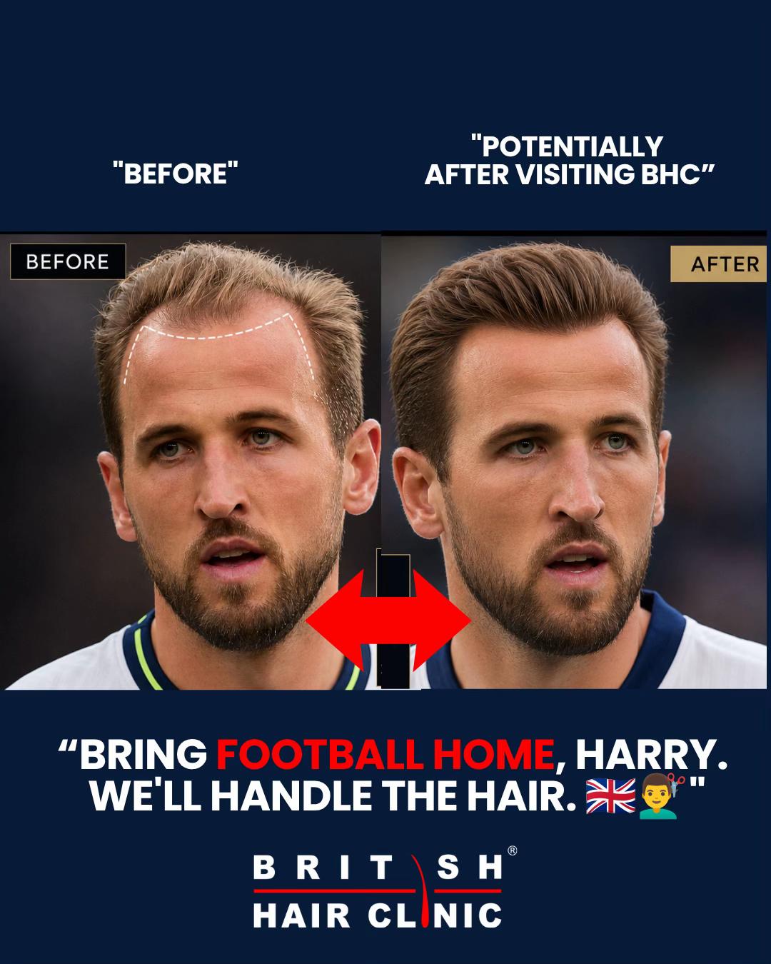 @British Hair Clinic