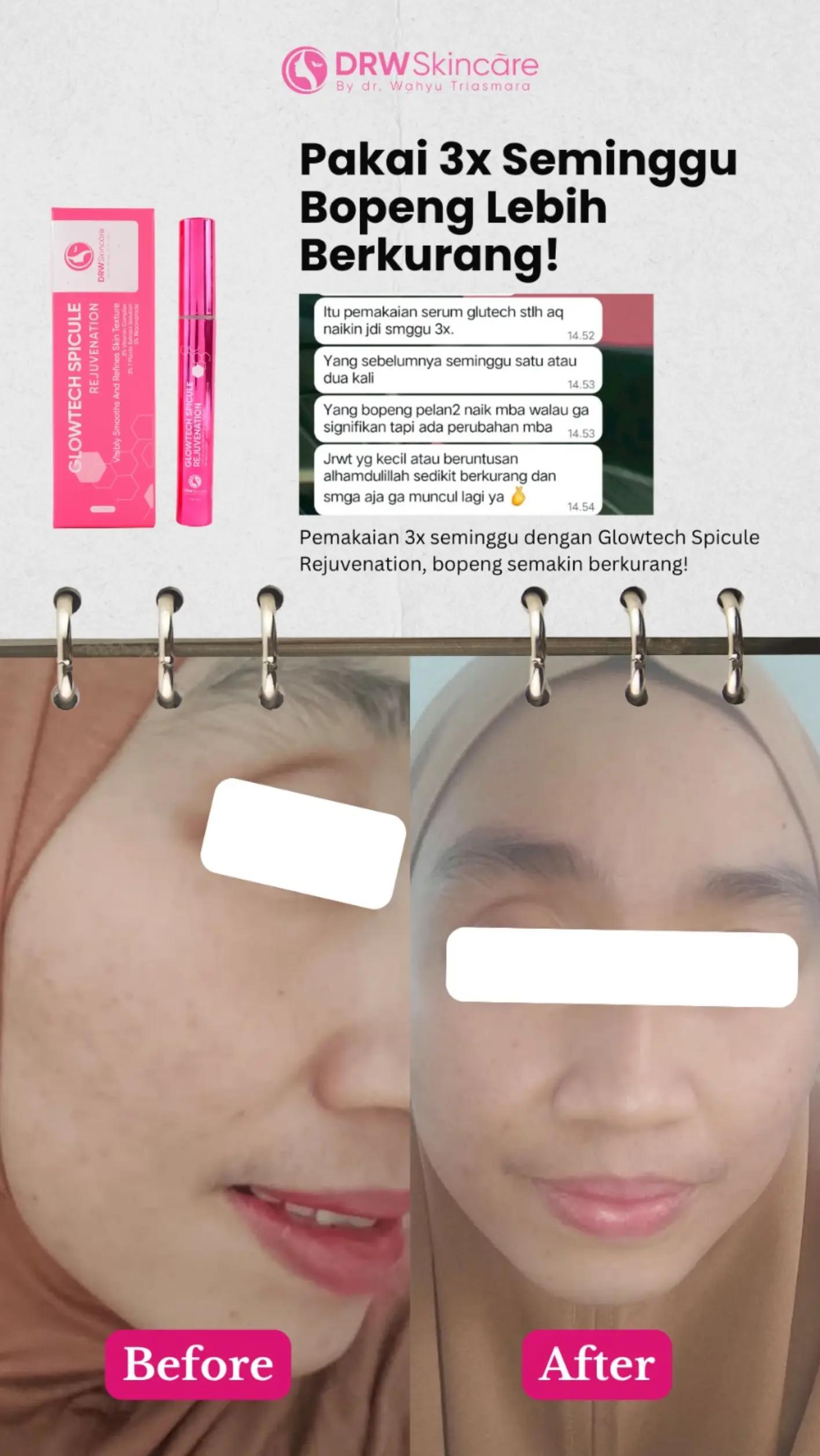 @Drw.Skincare Bali