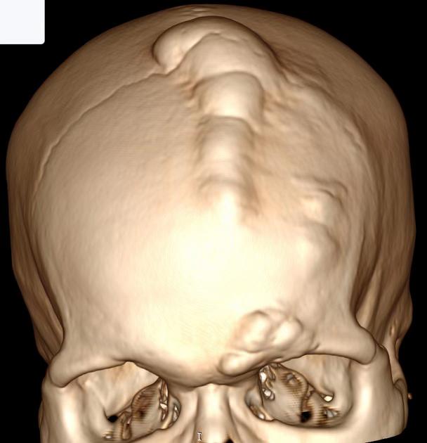 @Sobat Radiology