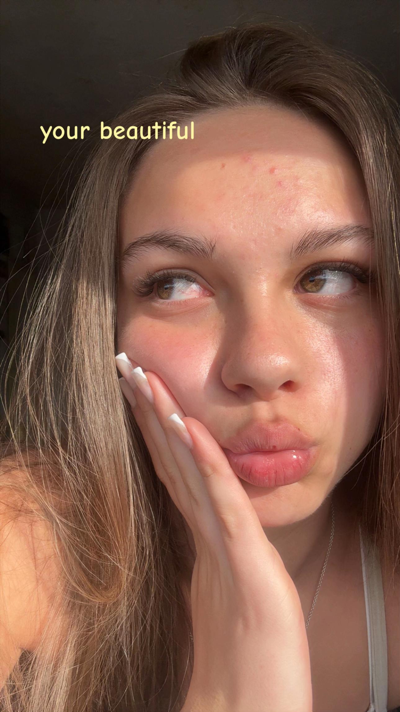 @Lily