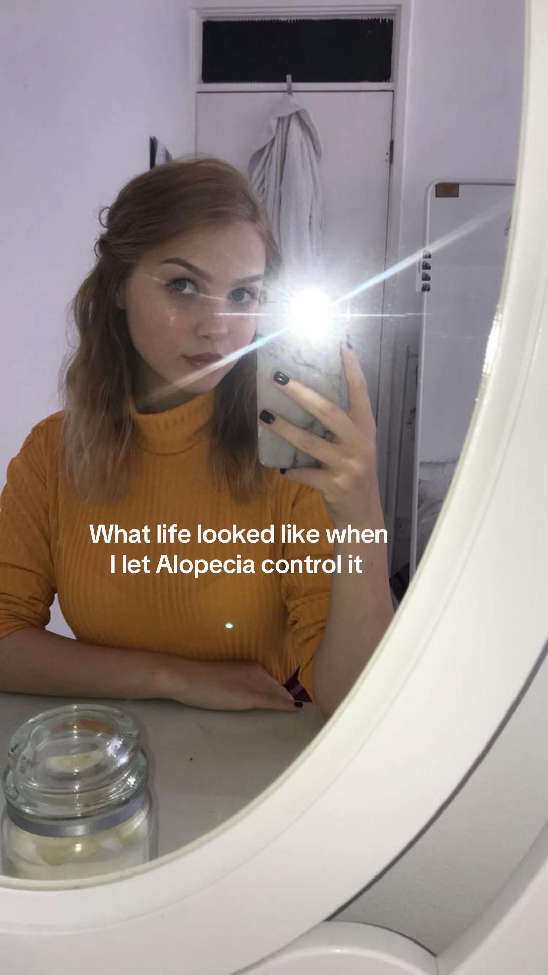 @Brooke💗Hair loss Journey