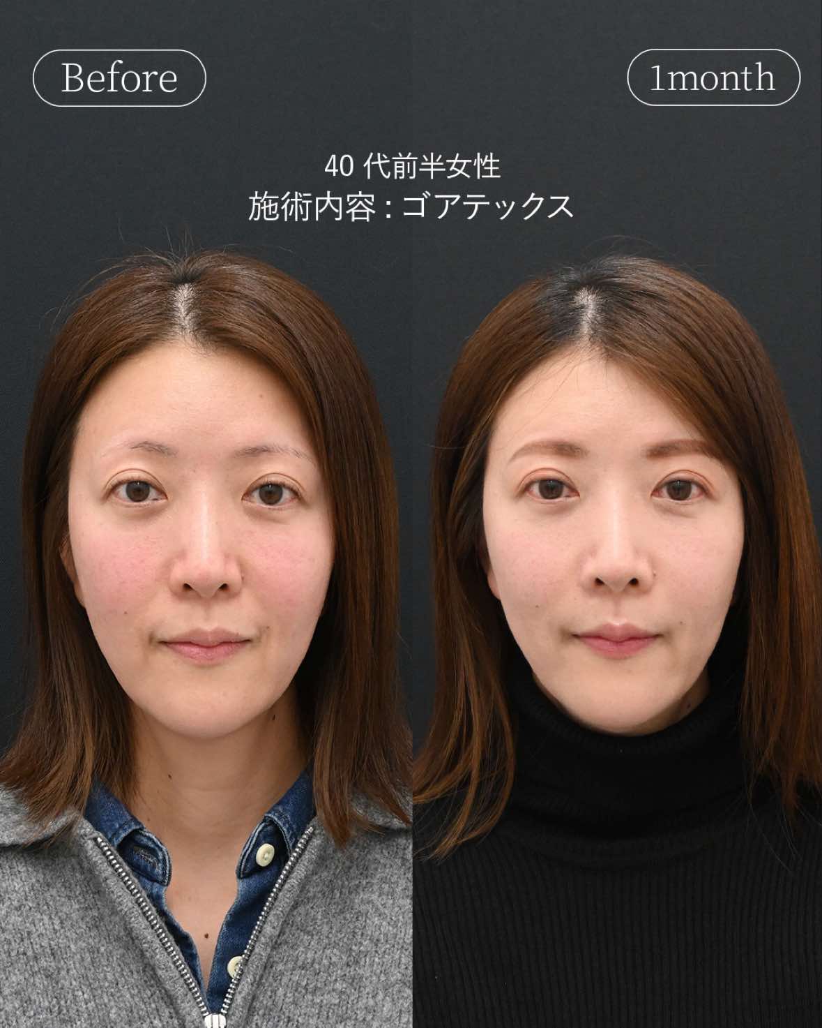 @名倉俊輔　輪郭.若返りの美容外科