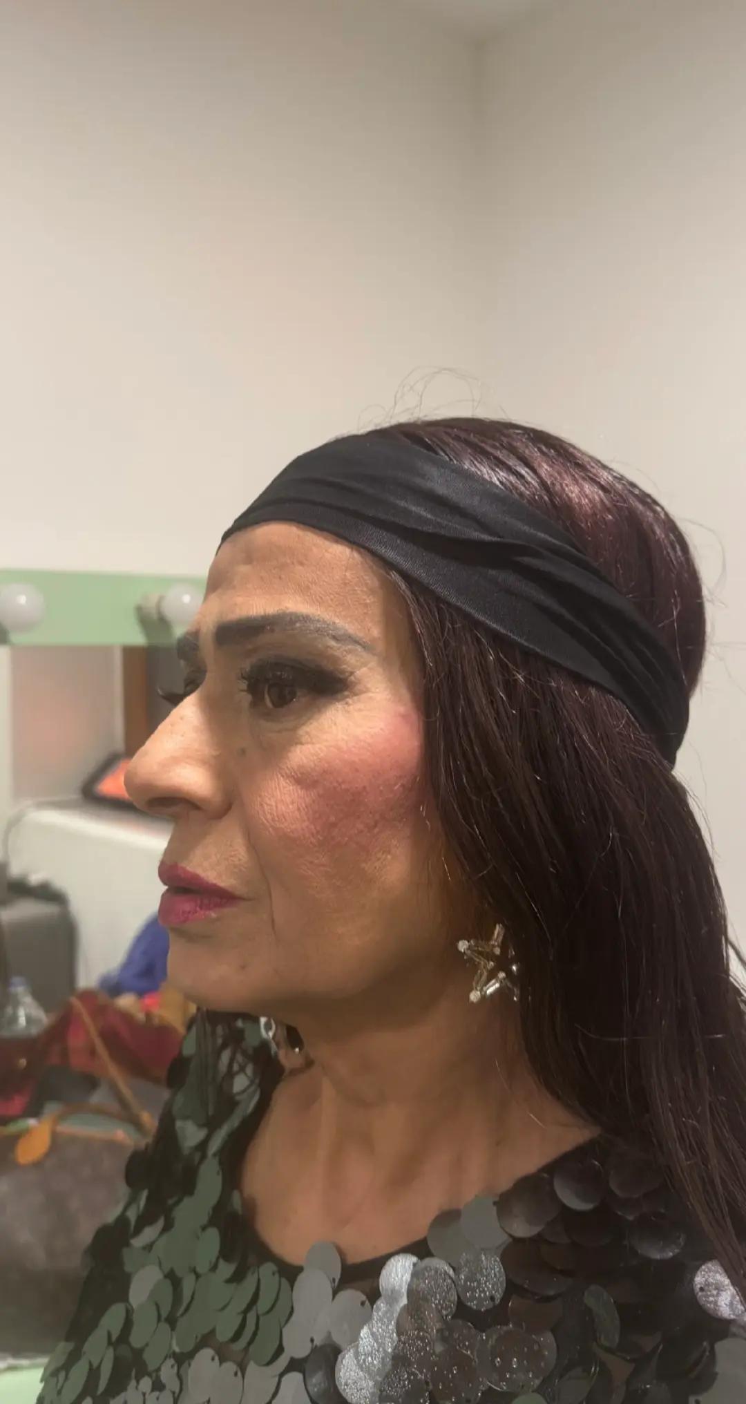 @Yıldız Tilbe