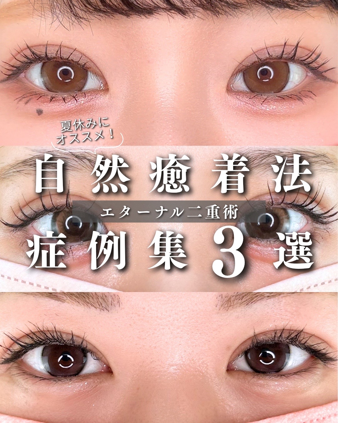 @ルラ美容クリニック大阪本院