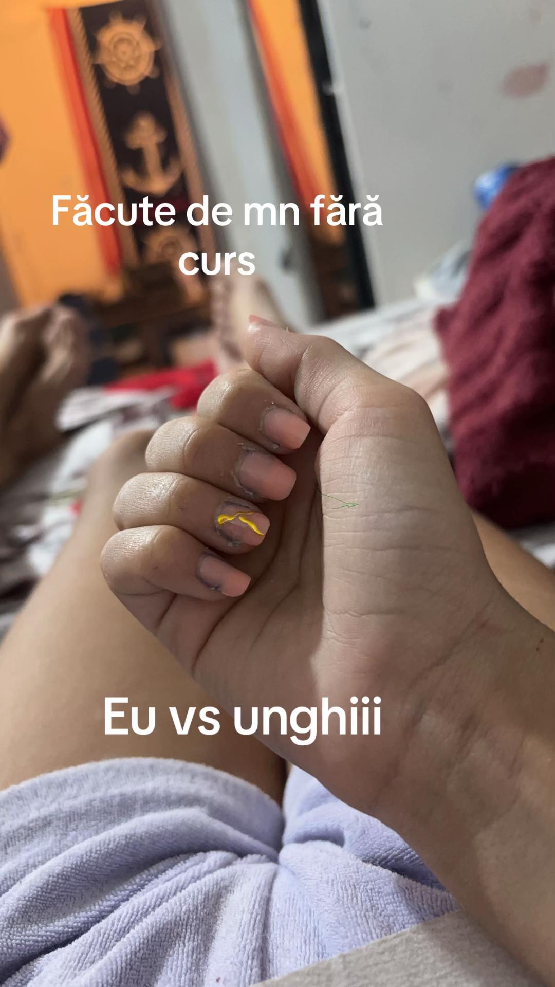 @Erika