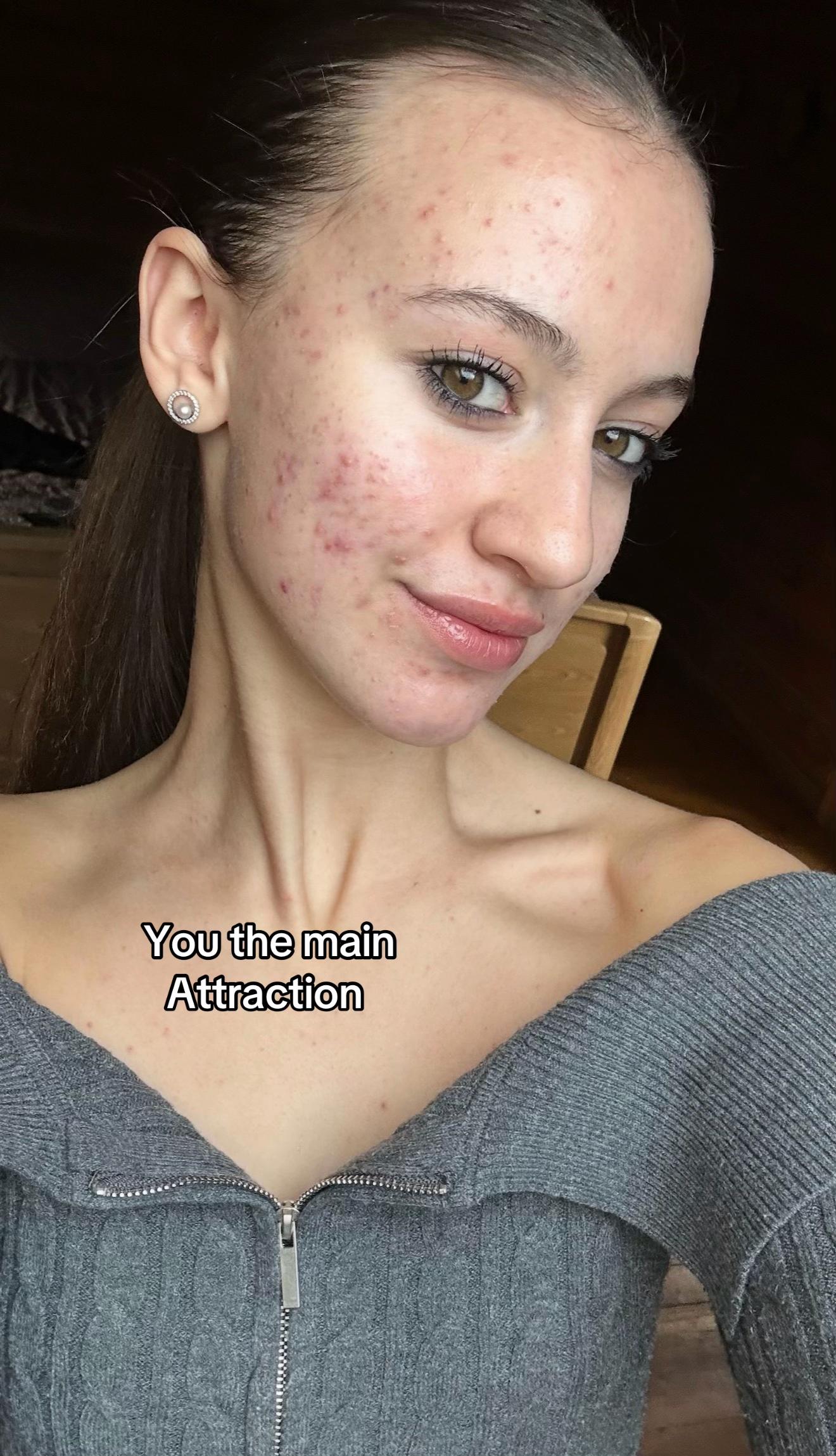 @li