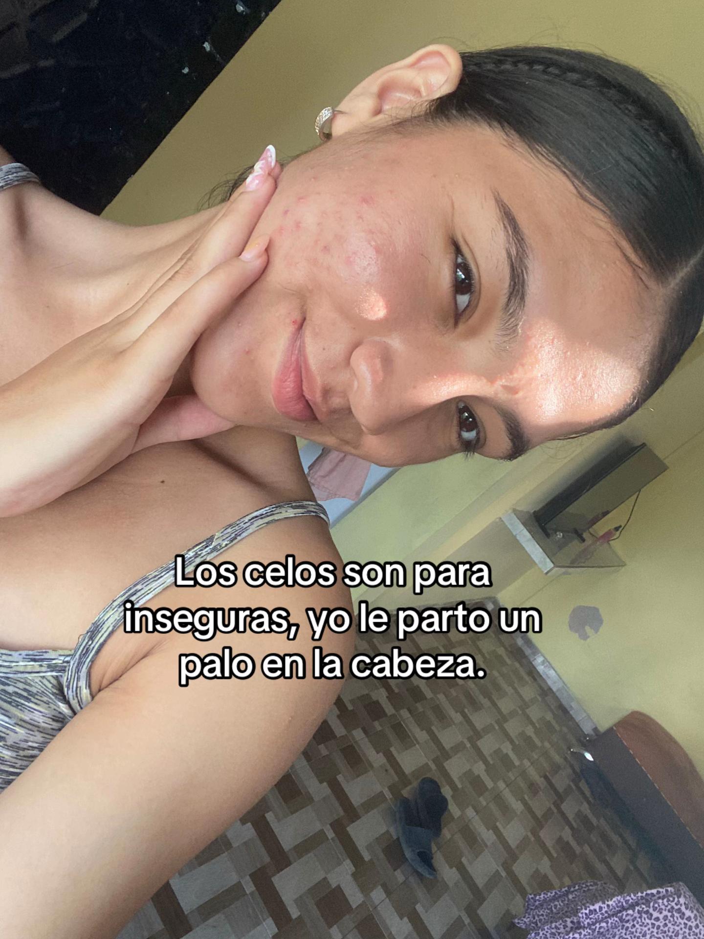 @Erikita ๐