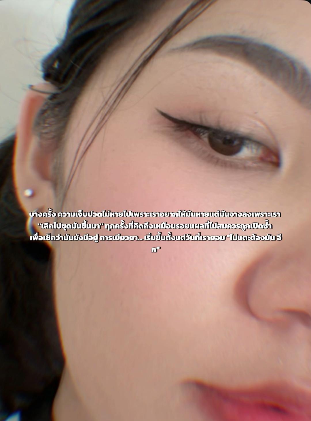 @M