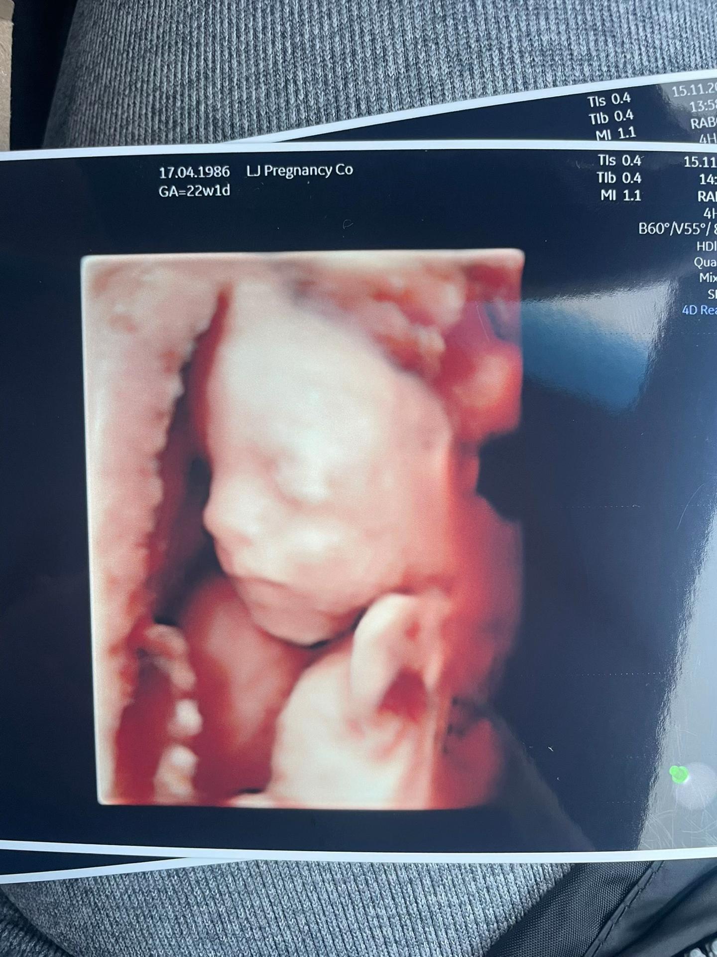 @laura_kirsty_ivf
