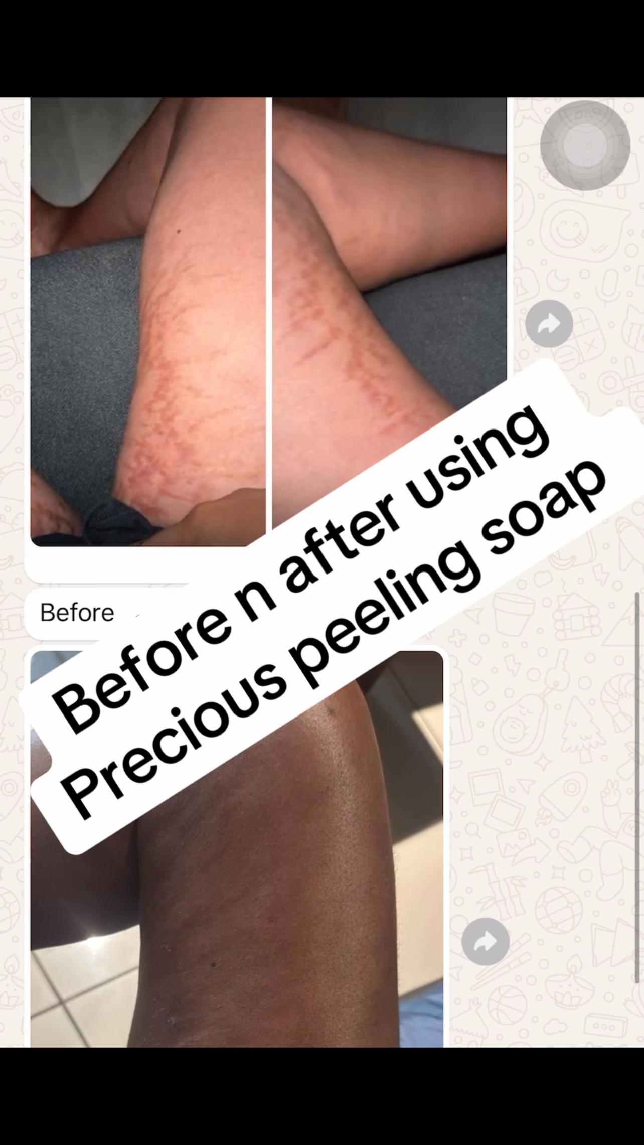 @@ Precious peeling soap