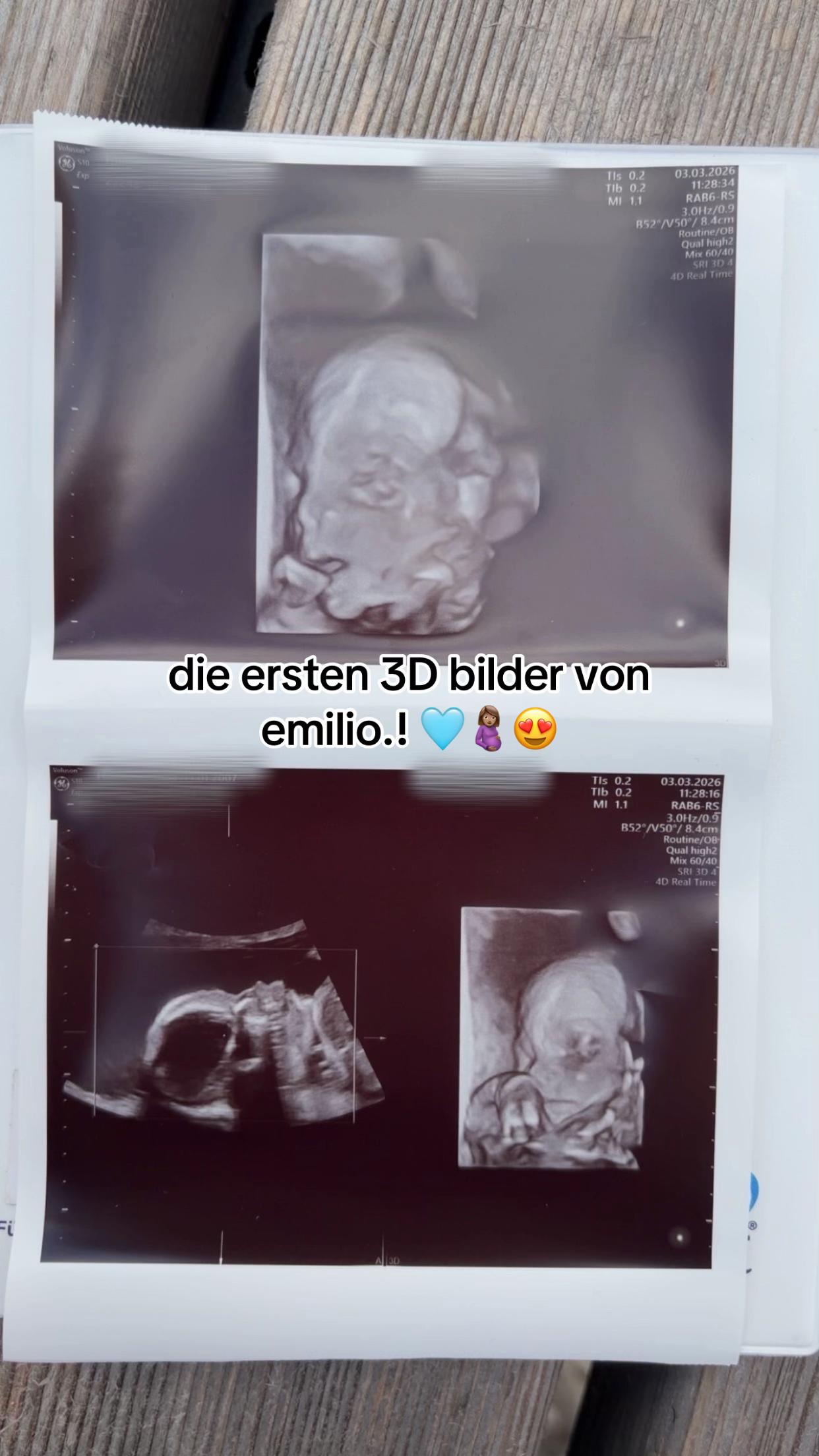 @𝓑𝓸𝔂 𝓜𝓸𝓶 🩵🤰🏽