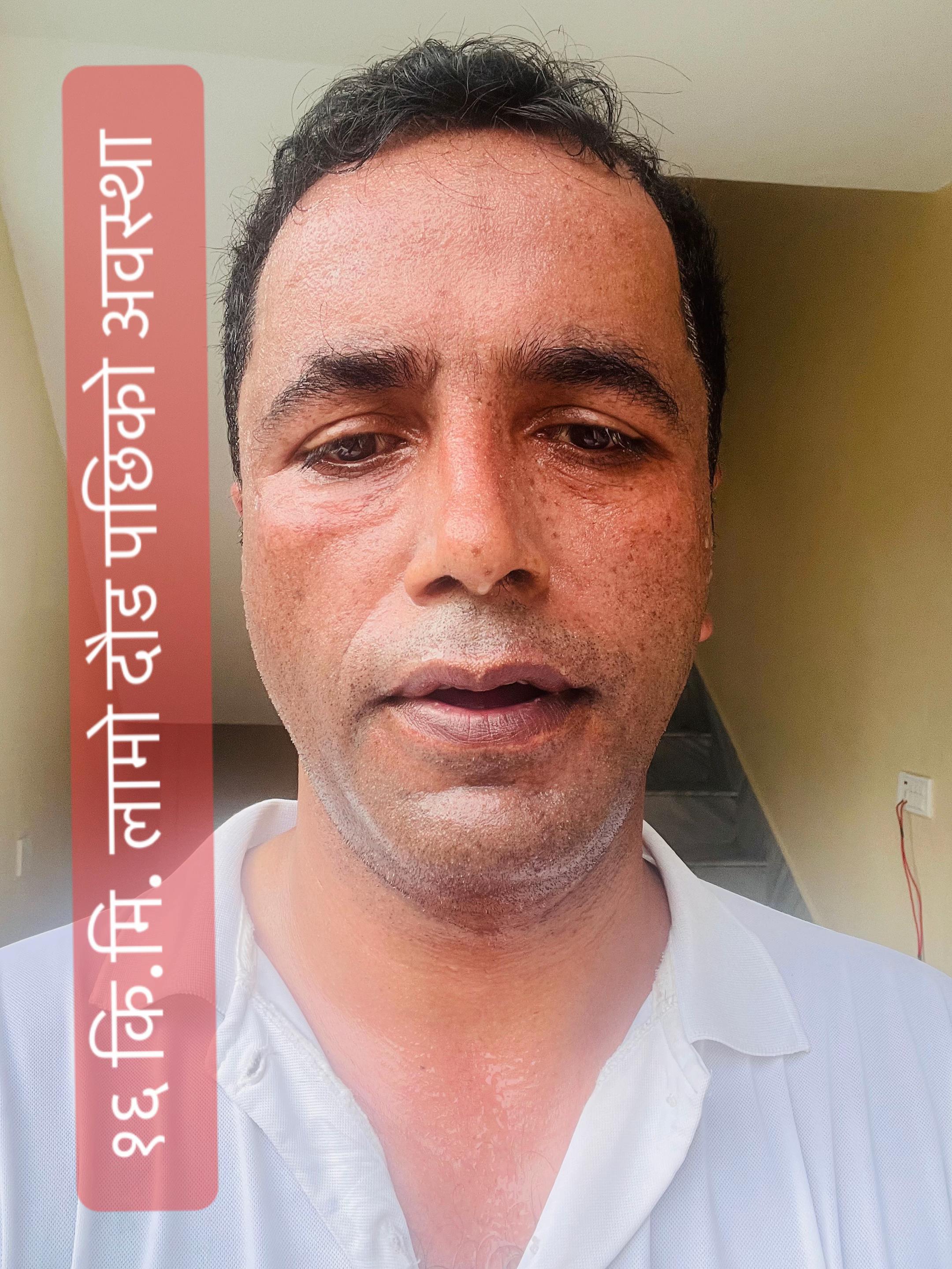 @युवराज दुलाल/YUBARAJ DULAL⭐️