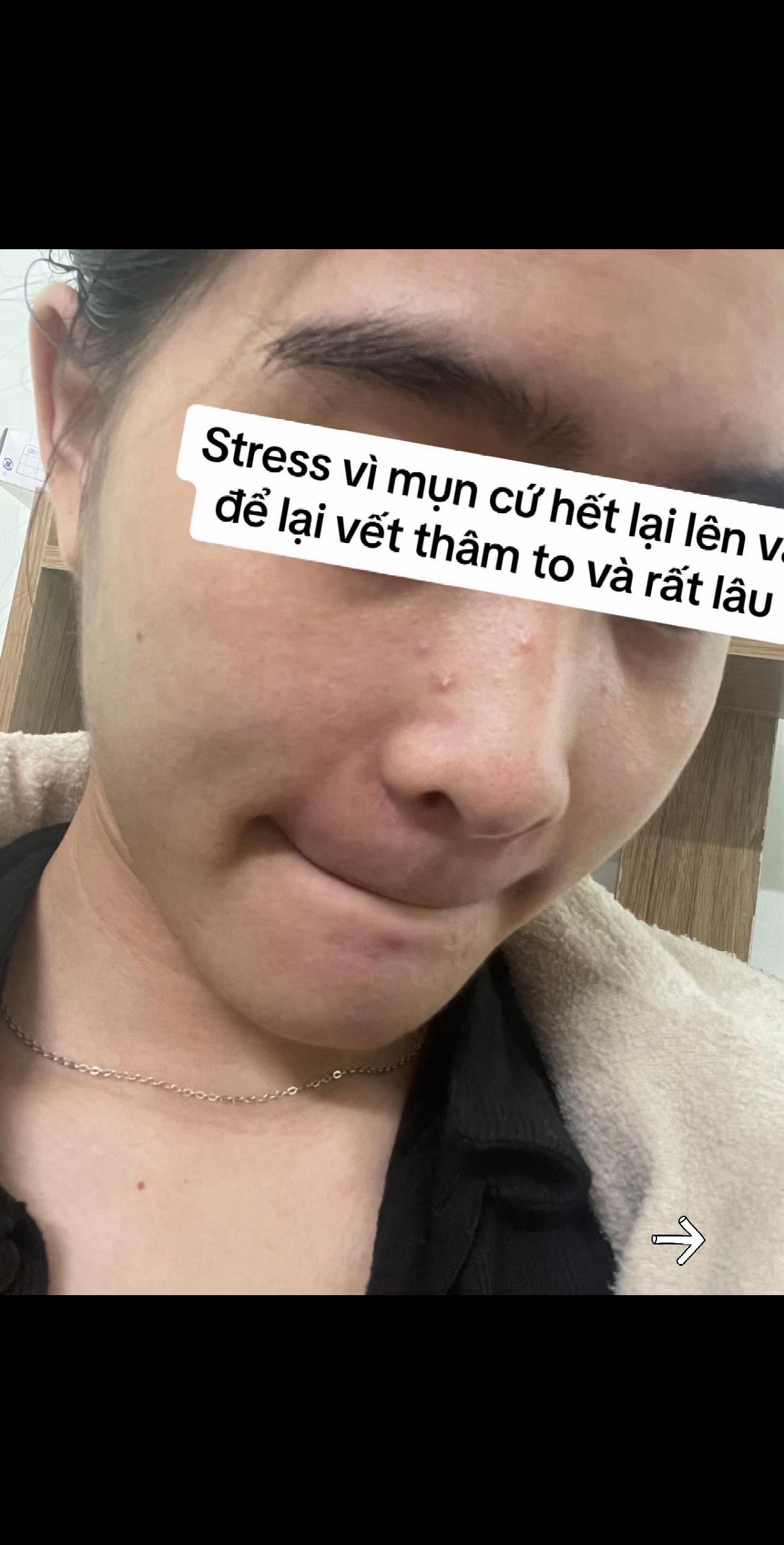 @Thảo NT Skincare