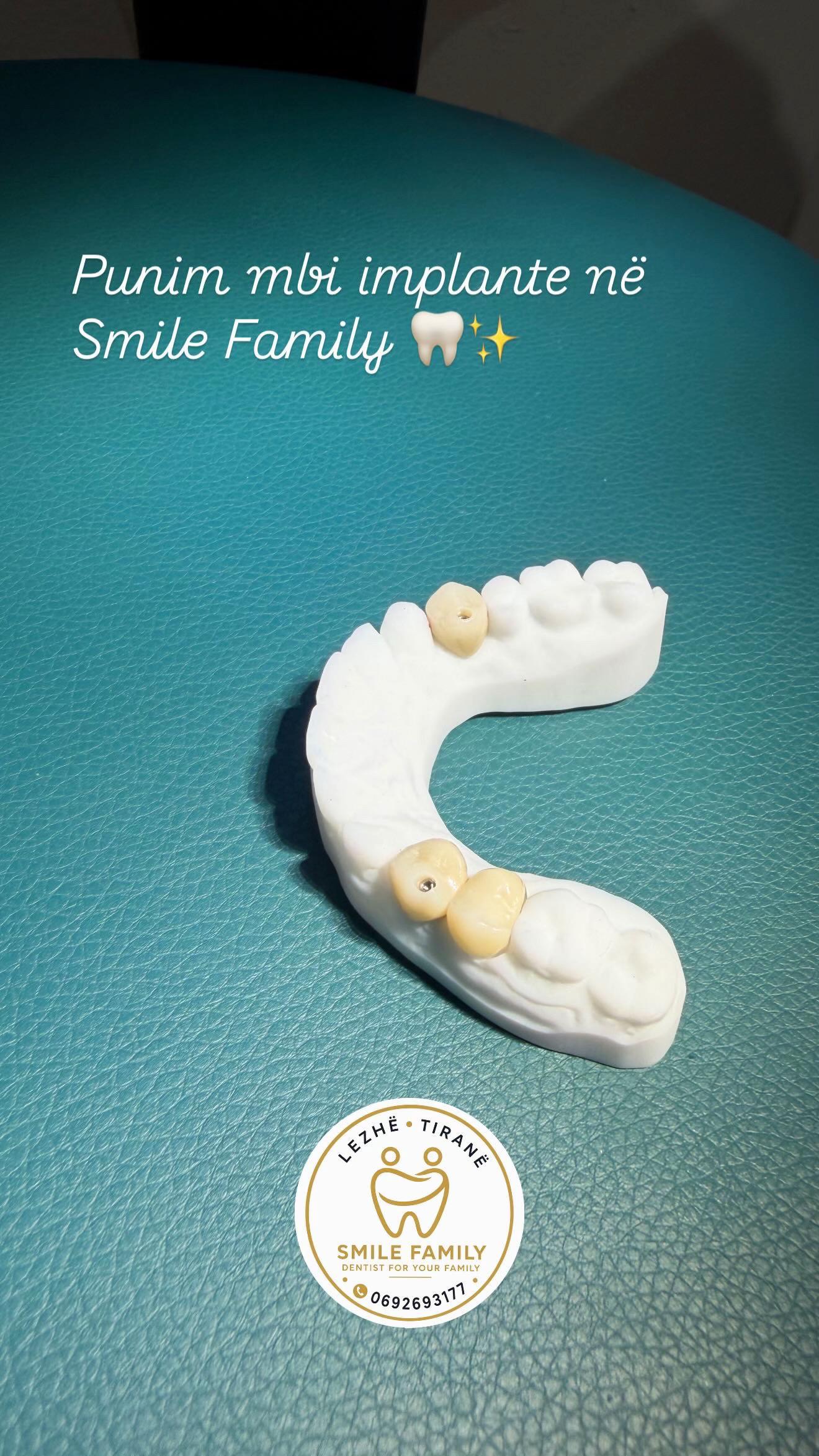 @Smile family_albania