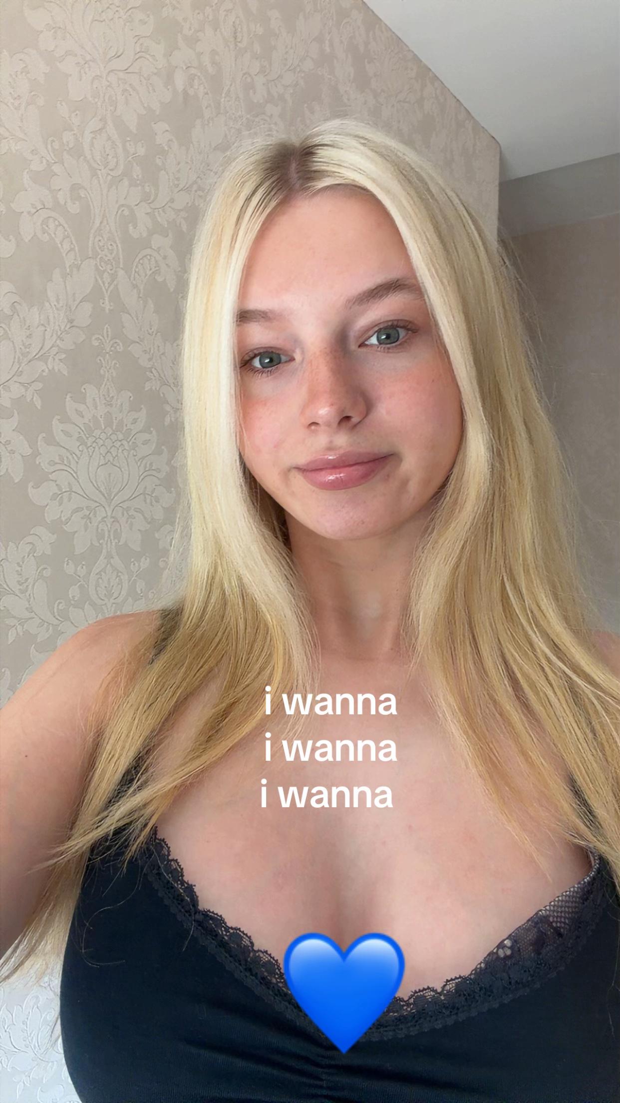 @SKYE