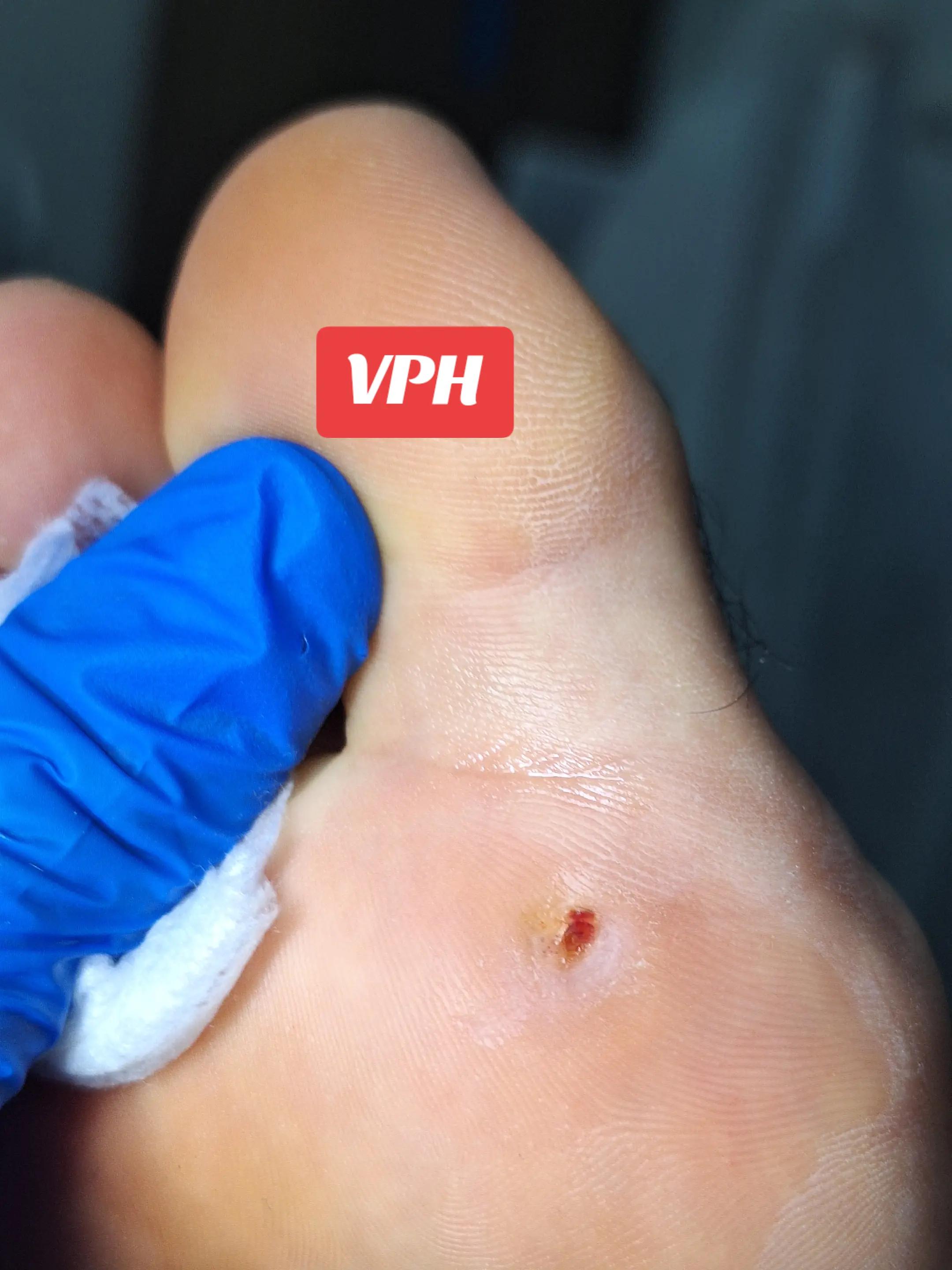 @Quiropodia HAPPY FOOT🇨🇷