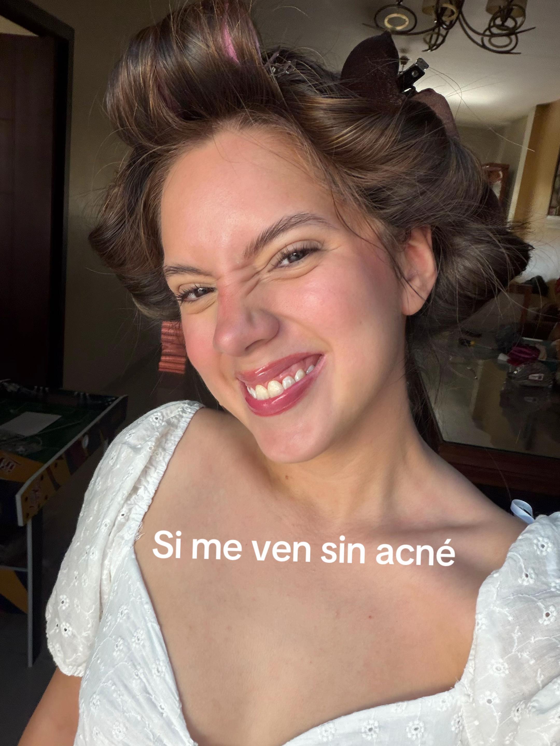 @Andrea Aguila