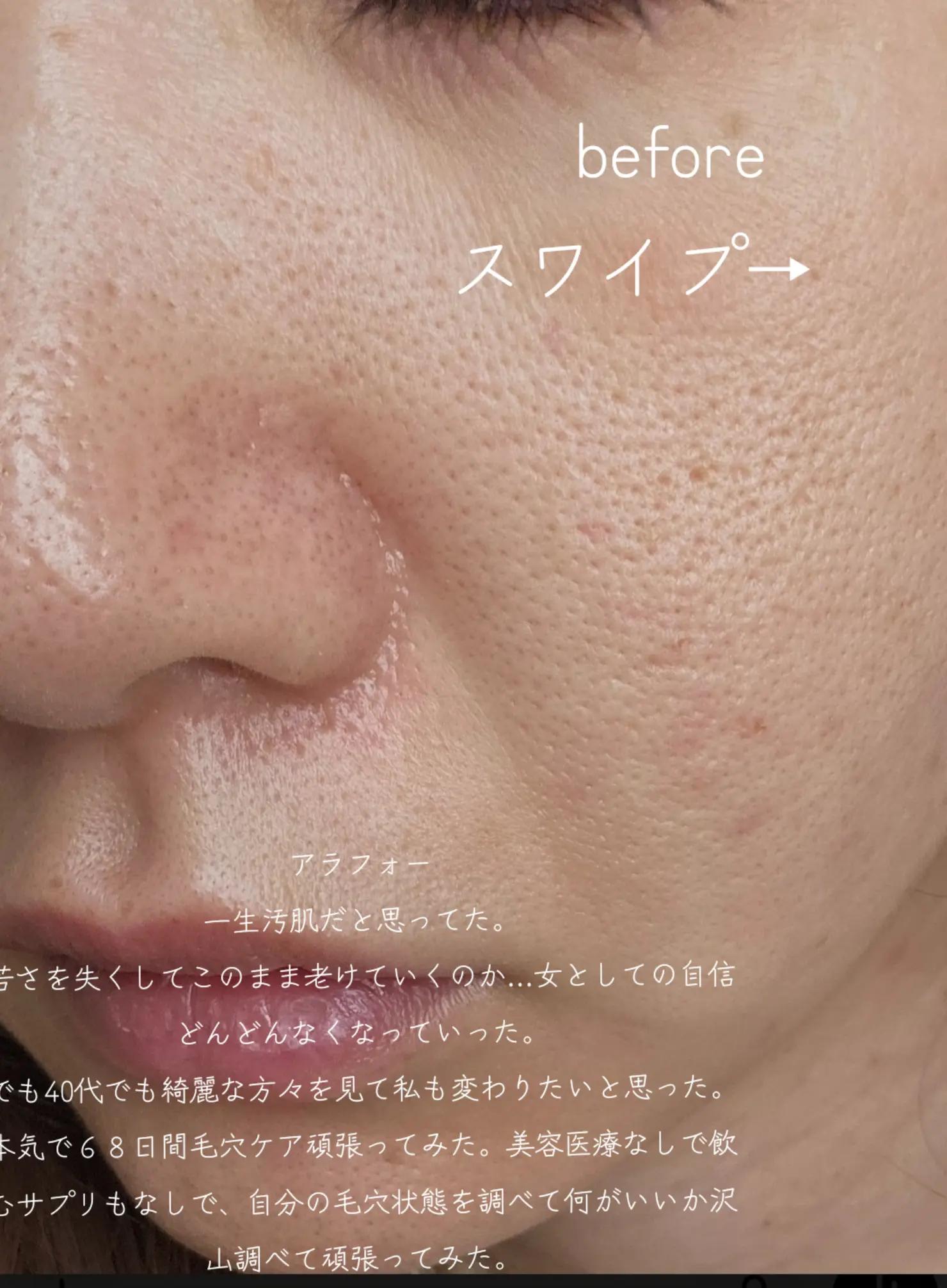 @リアル毛穴改善記録