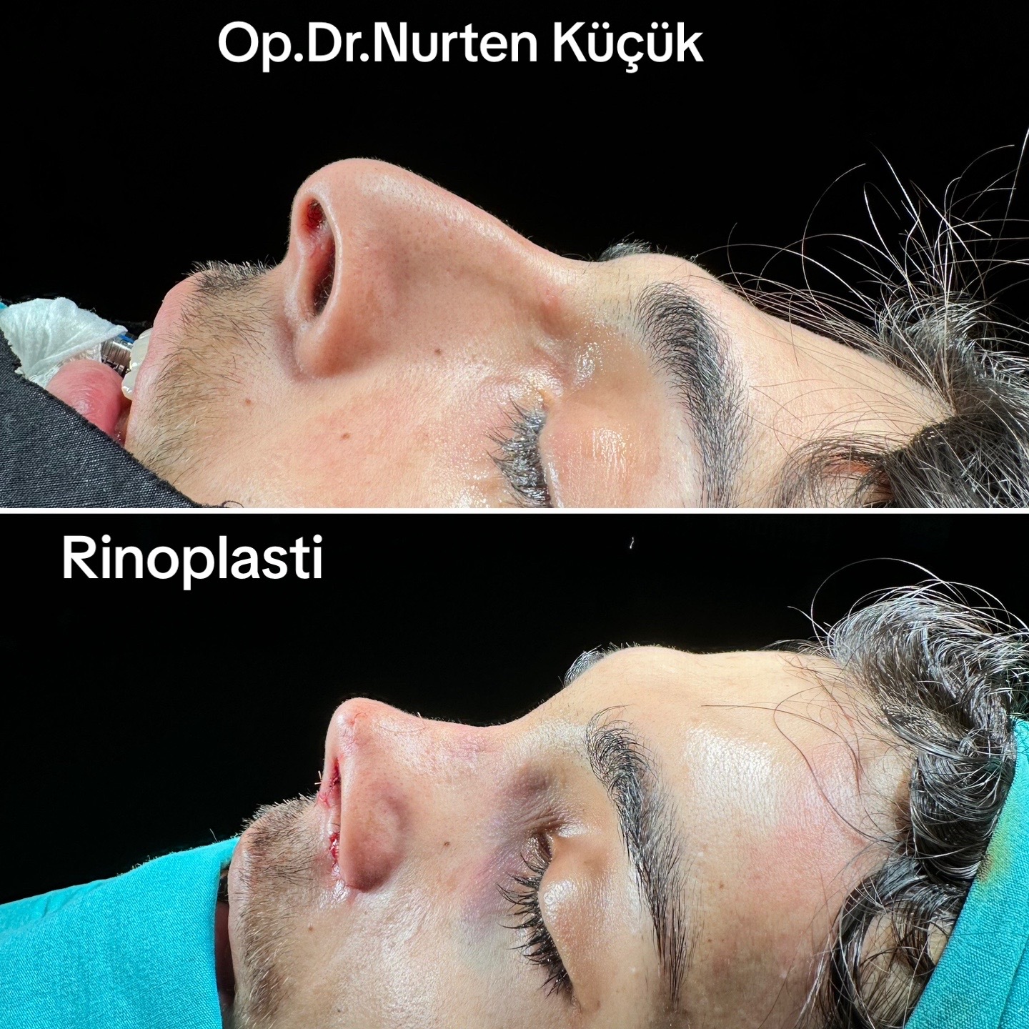 @Dr. NurtenKucuk
