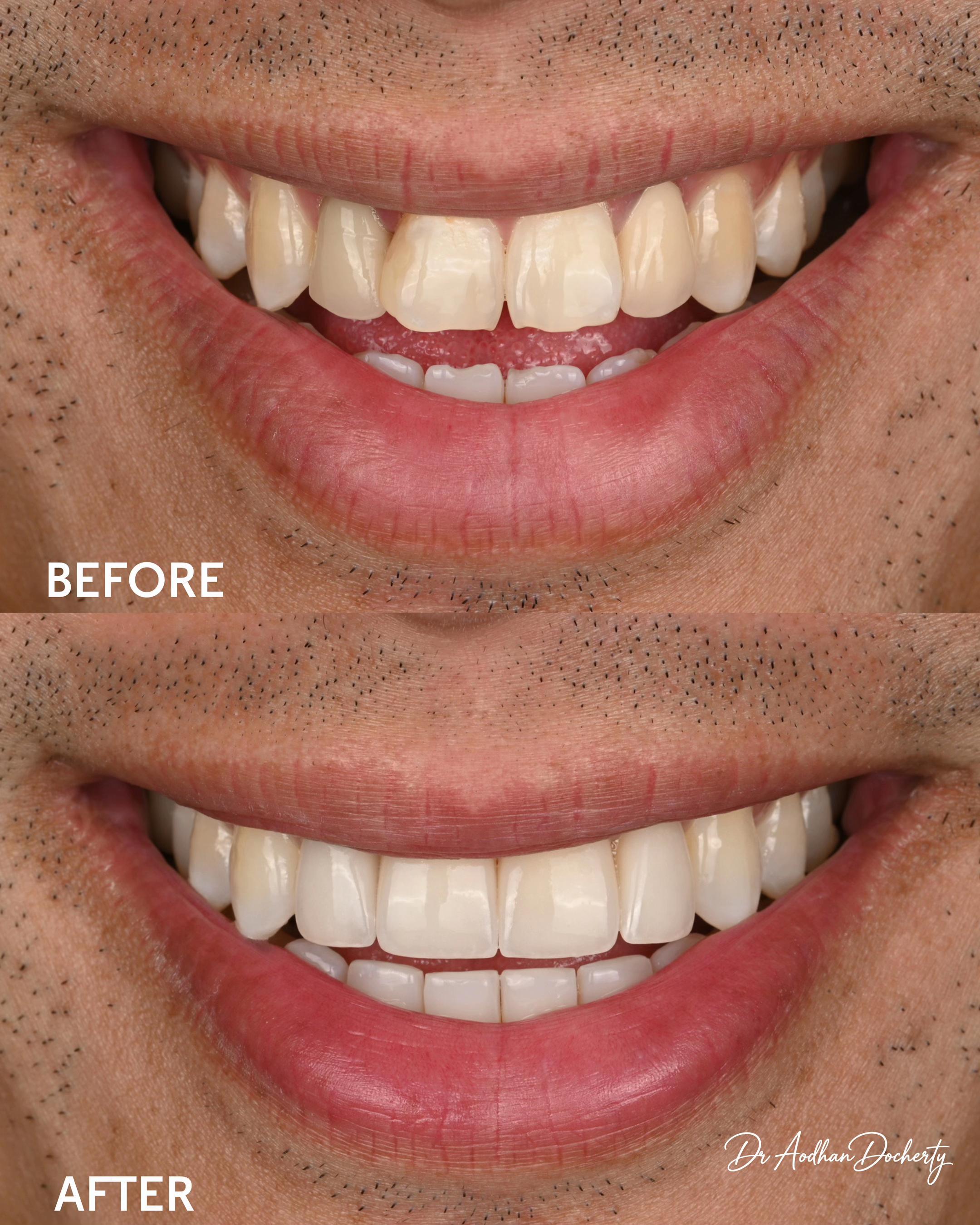 @Sydney Dentist | Dr Aodhan