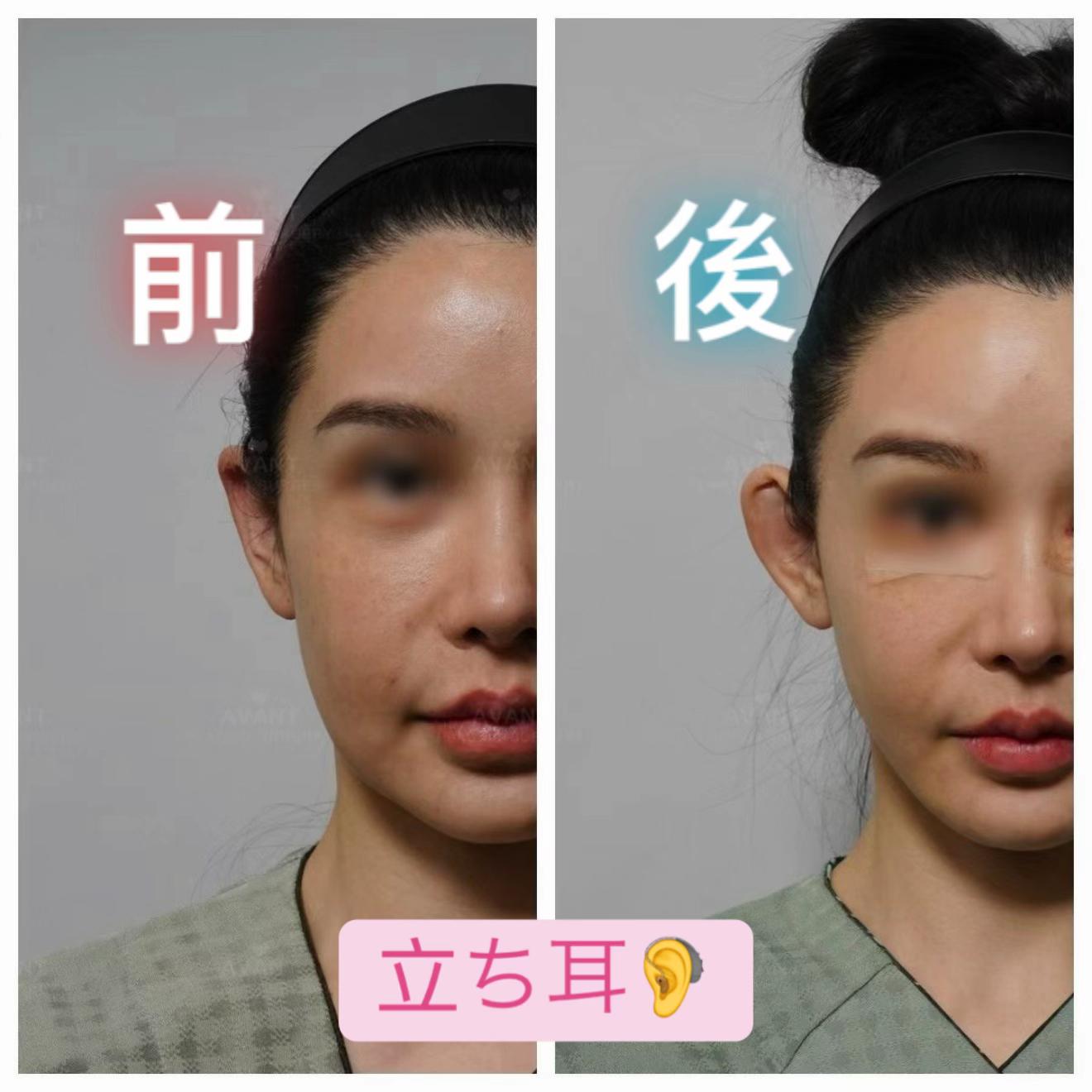 @Avant美容外科