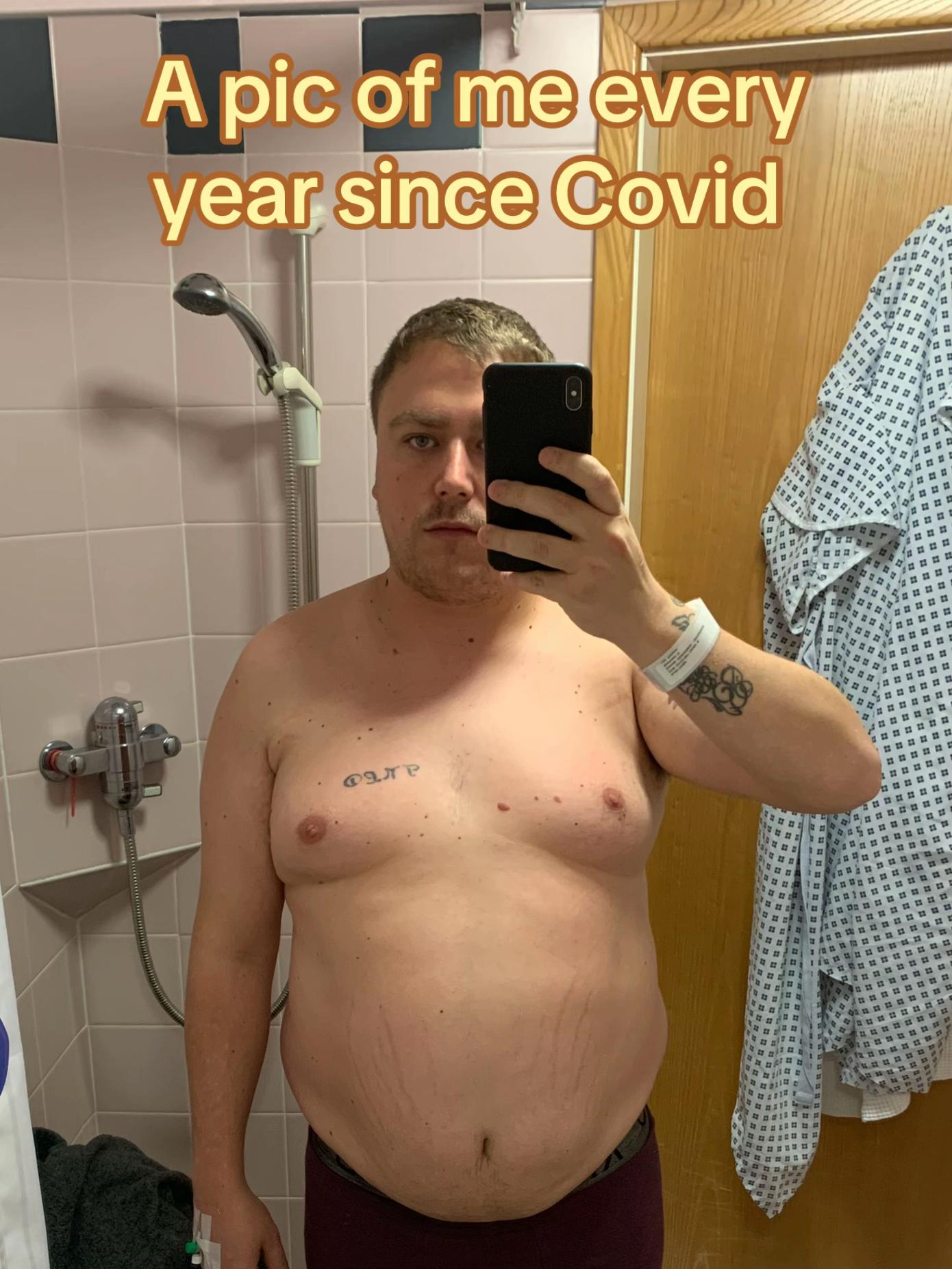 @KD | Life After Weight Loss