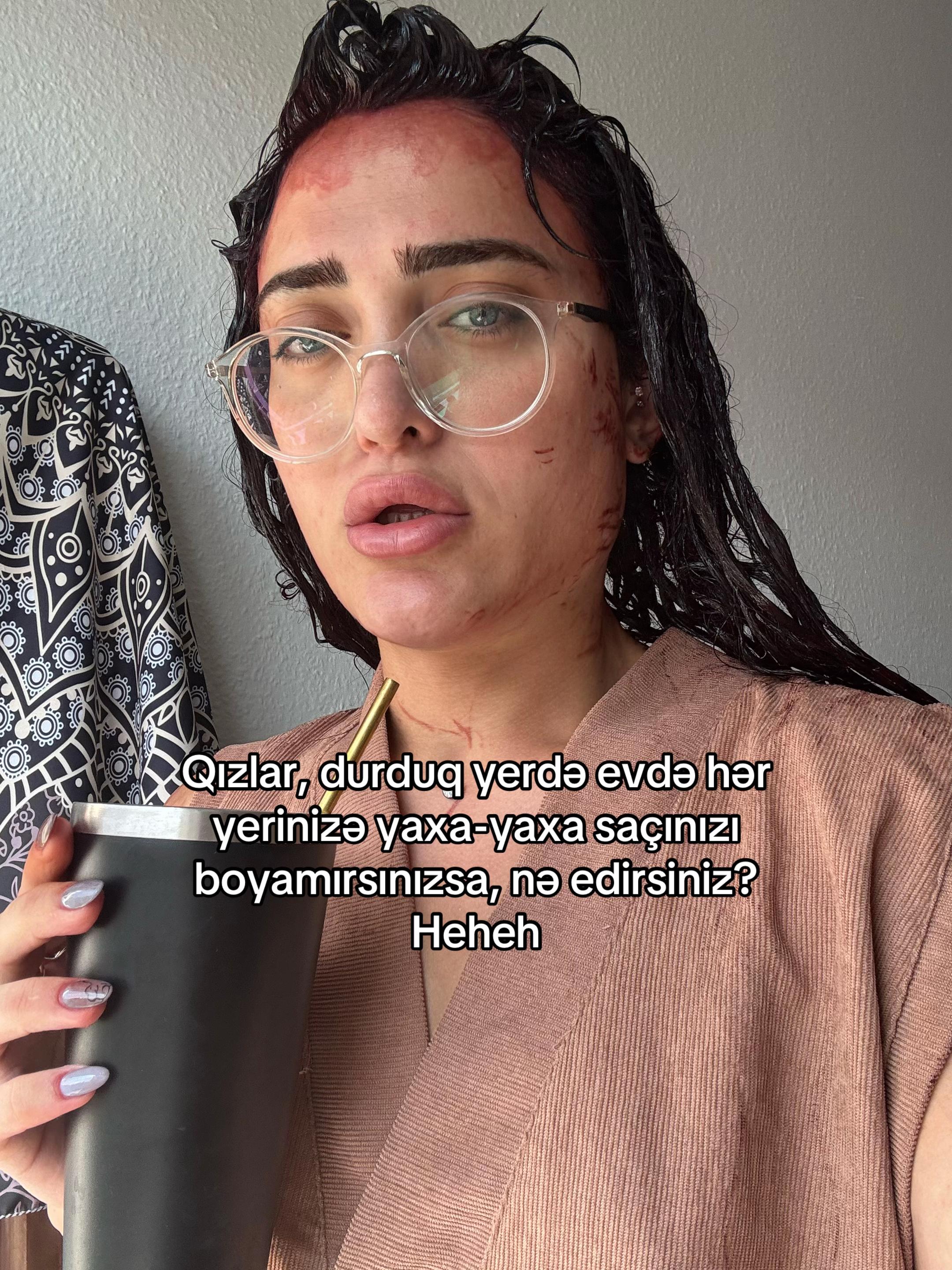 @Miray Daniz