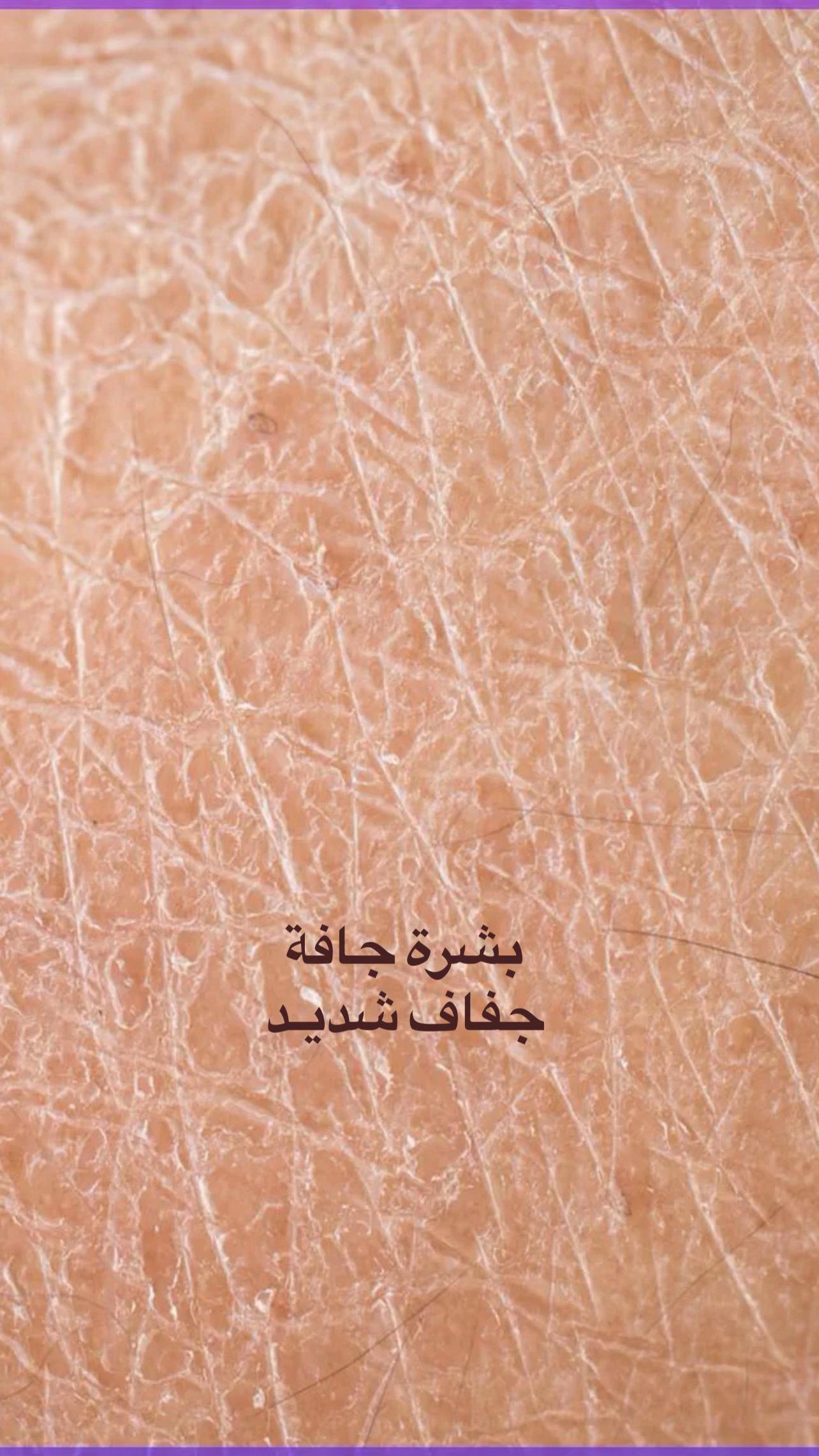 @كـوزمتـك وَتـيـن ✨