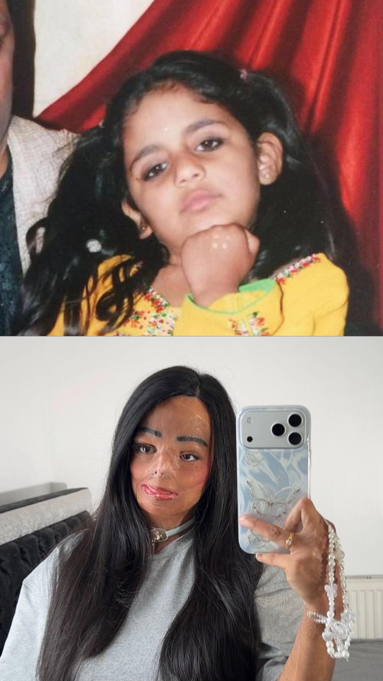 @aleema