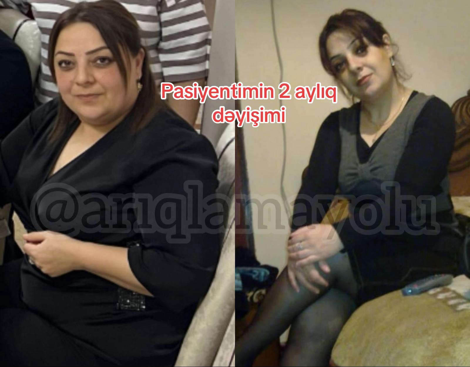 @Nutrisioloq Nilay Camalova 🥑