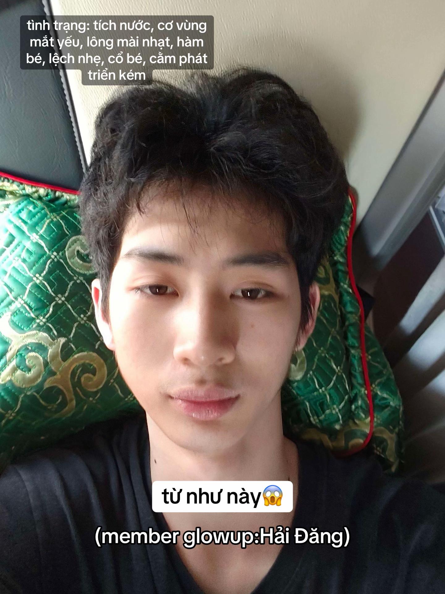 @Trippy