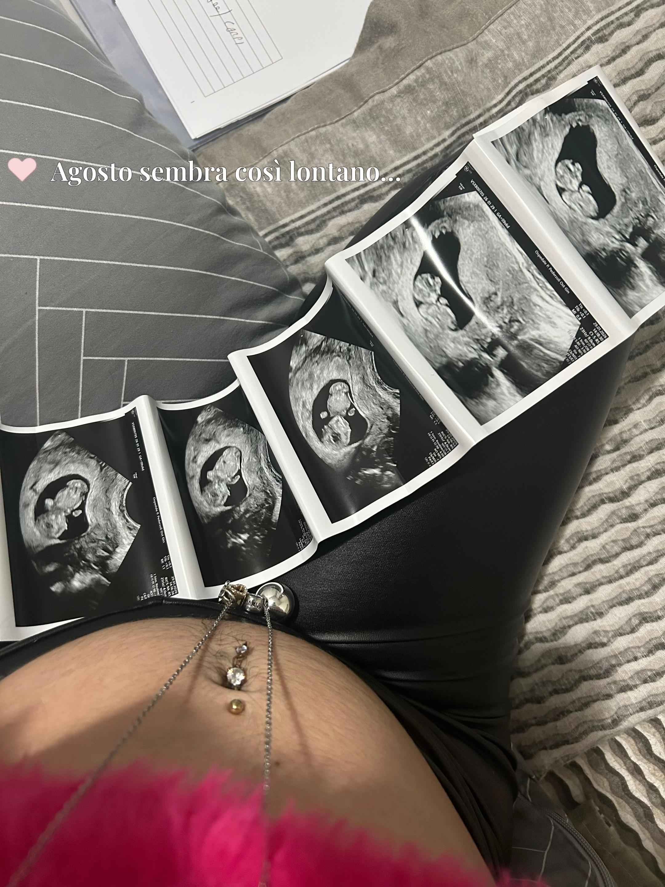 @🩷Mom to be Aurora Maria🩷