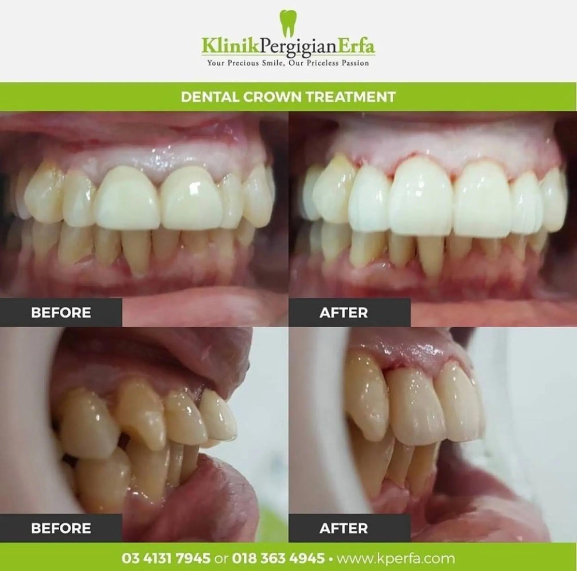 @Klinik Pergigian Erfa