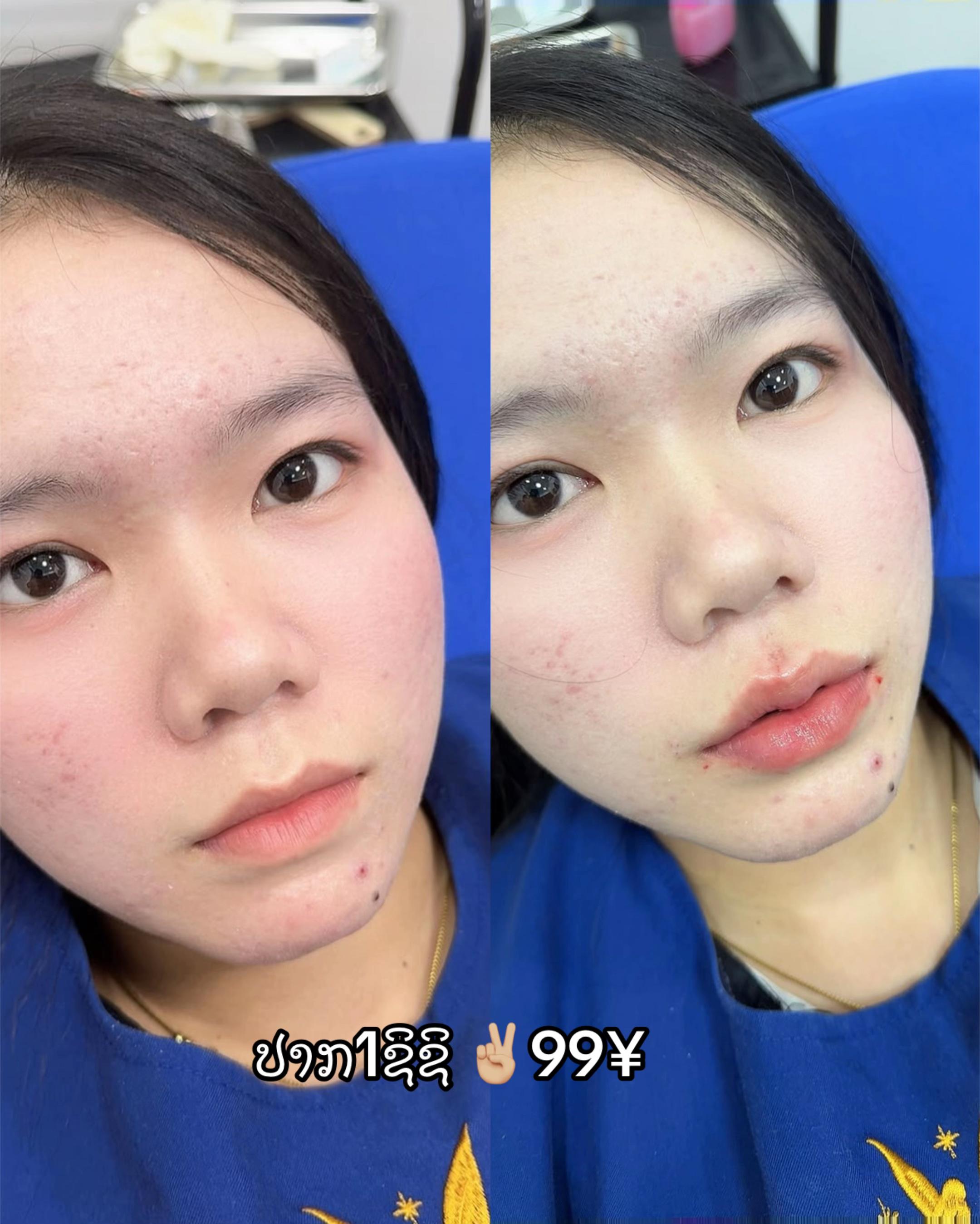 @ຫມໍນາ ສູນຄວາມງາມແຟຮຣີ້