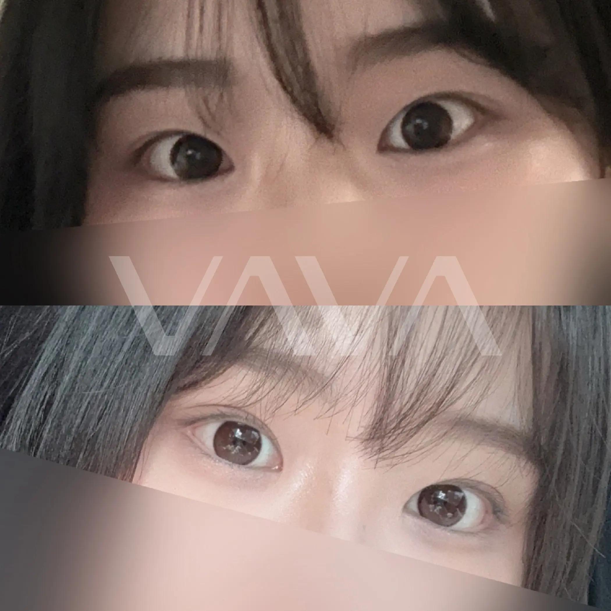 @VAVA美容整形外科