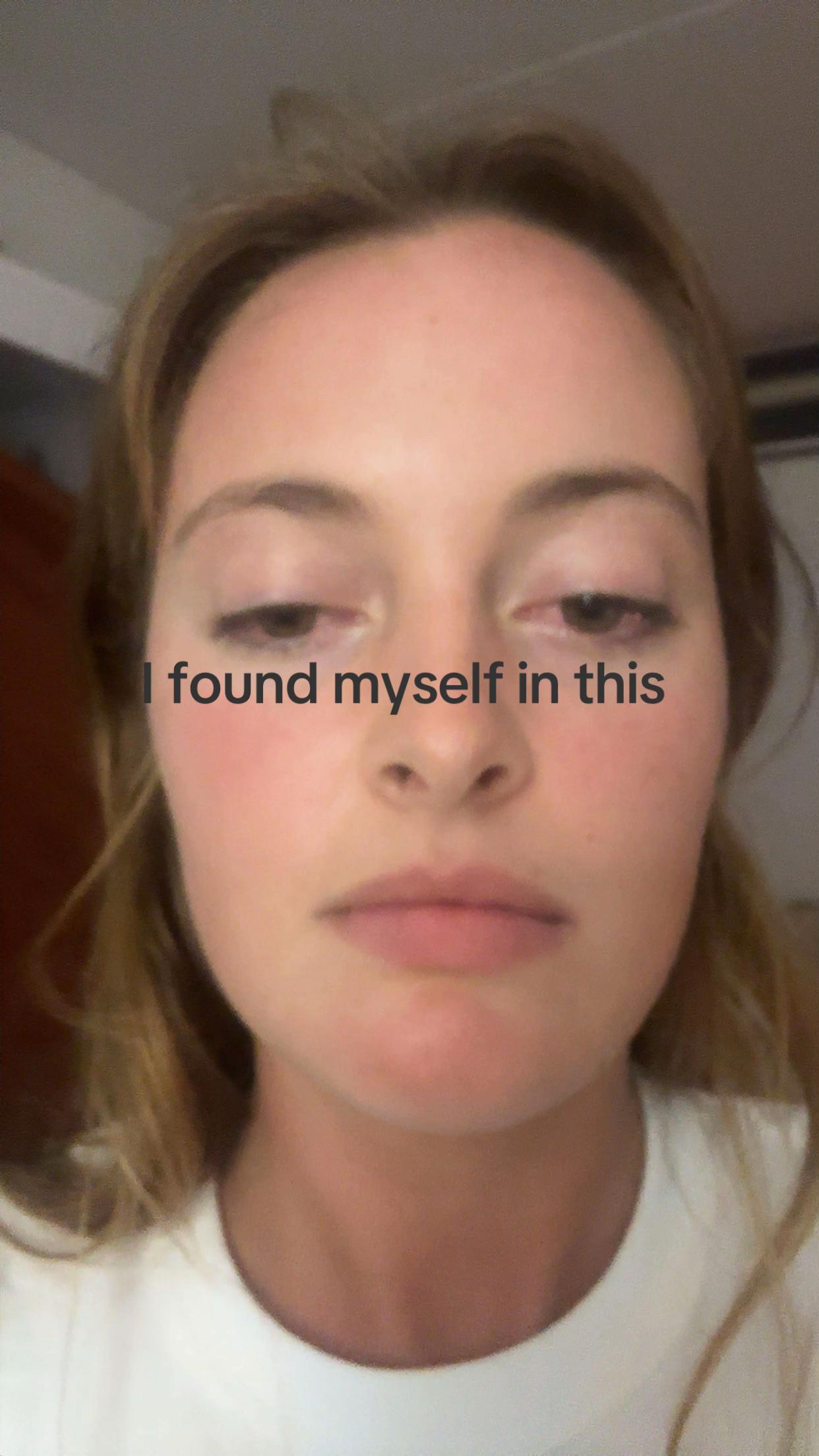 @bb