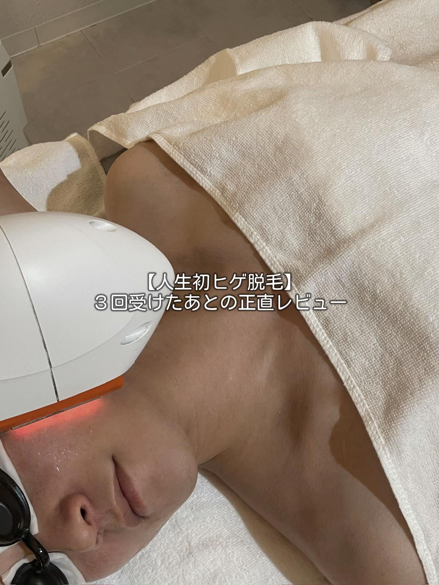 @メンズ脱毛サロンsilkymen’s札幌