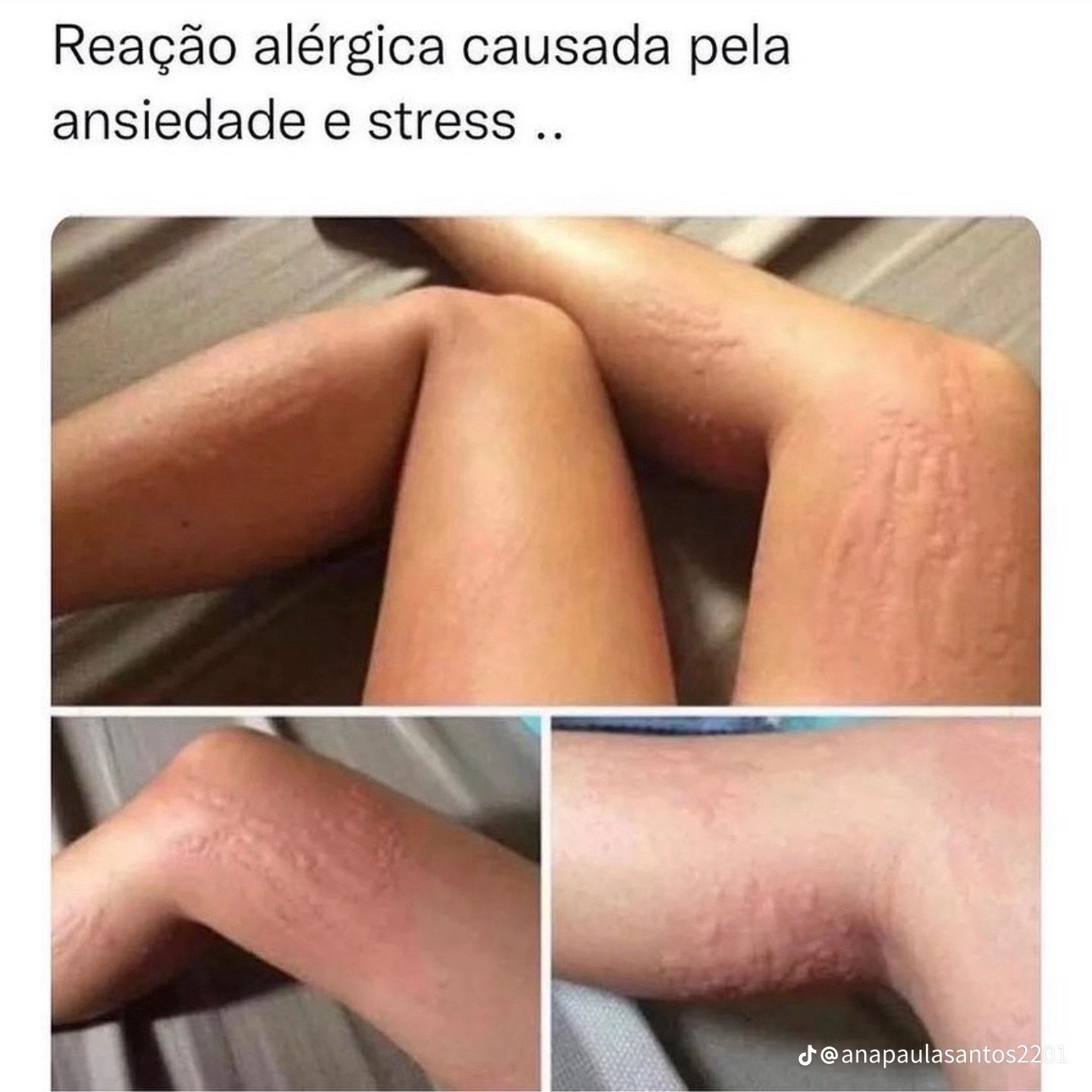 @Manuellen Senhorães
