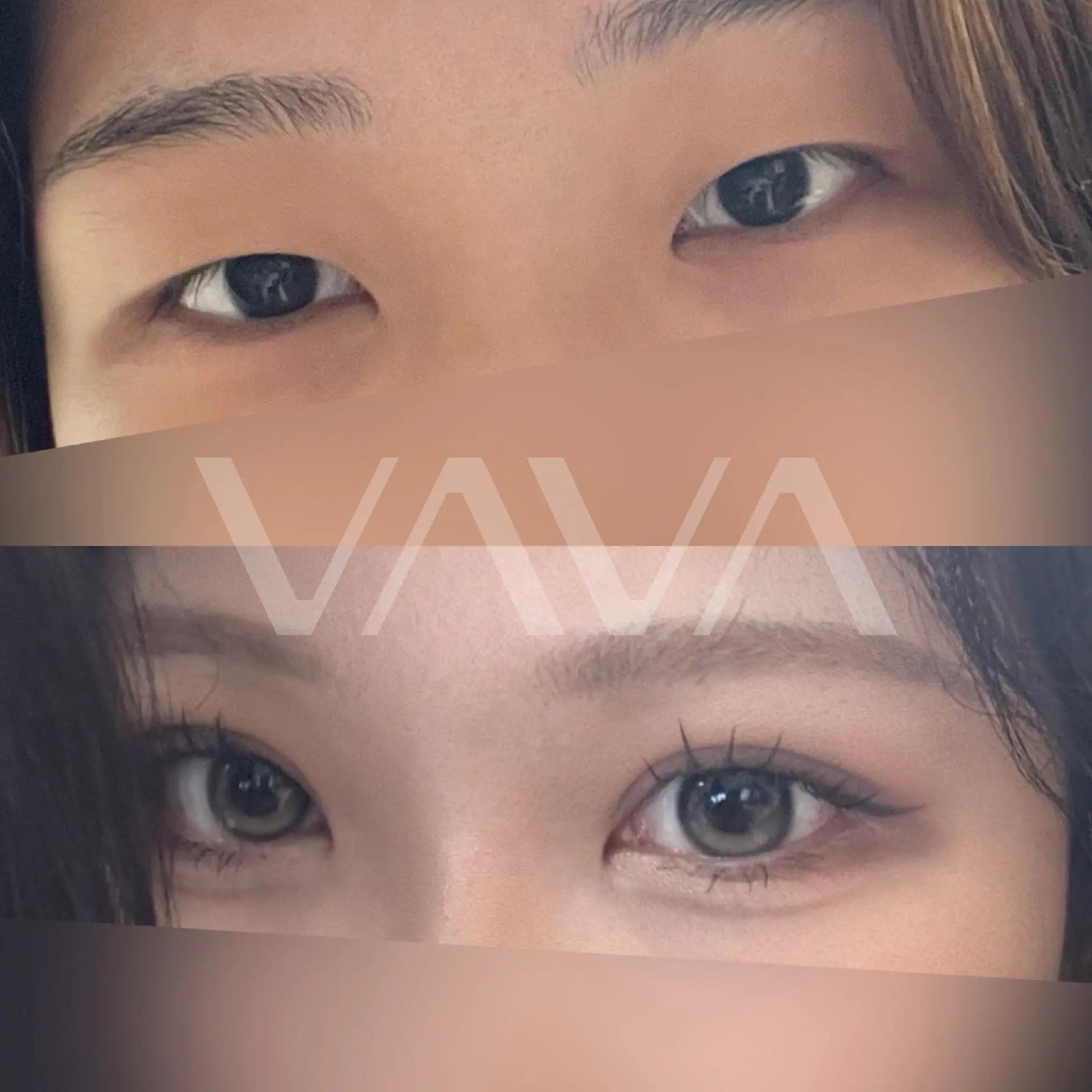 @VAVA美容整形外科